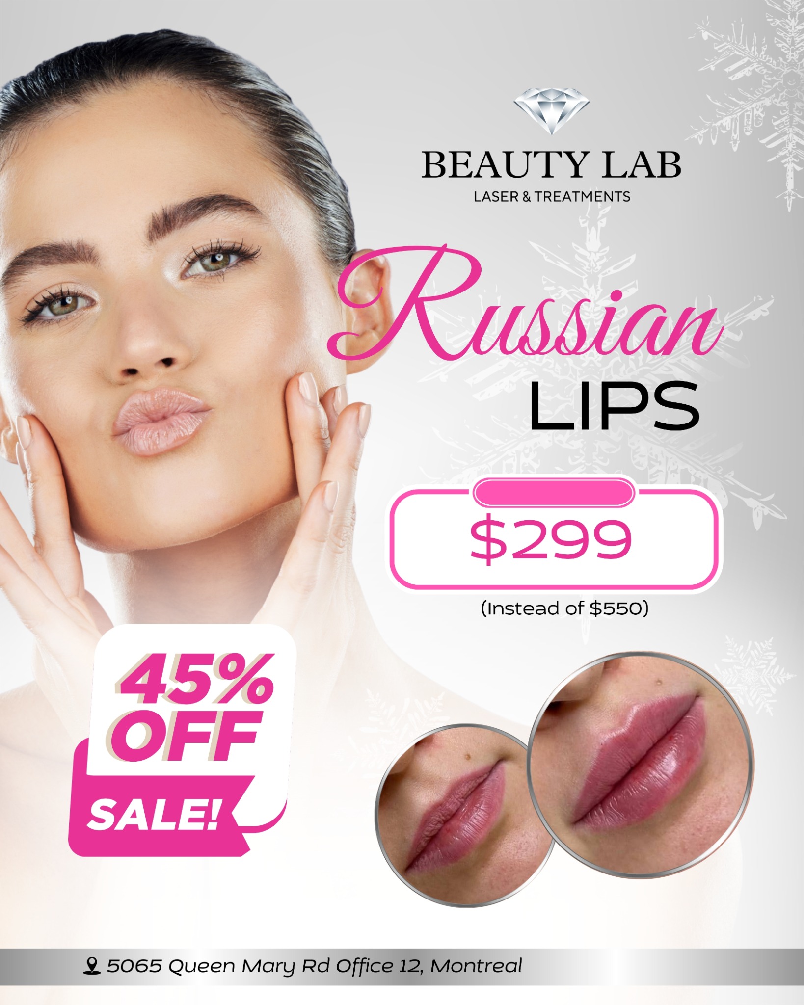 Beauty Lab Laser Facebook ad