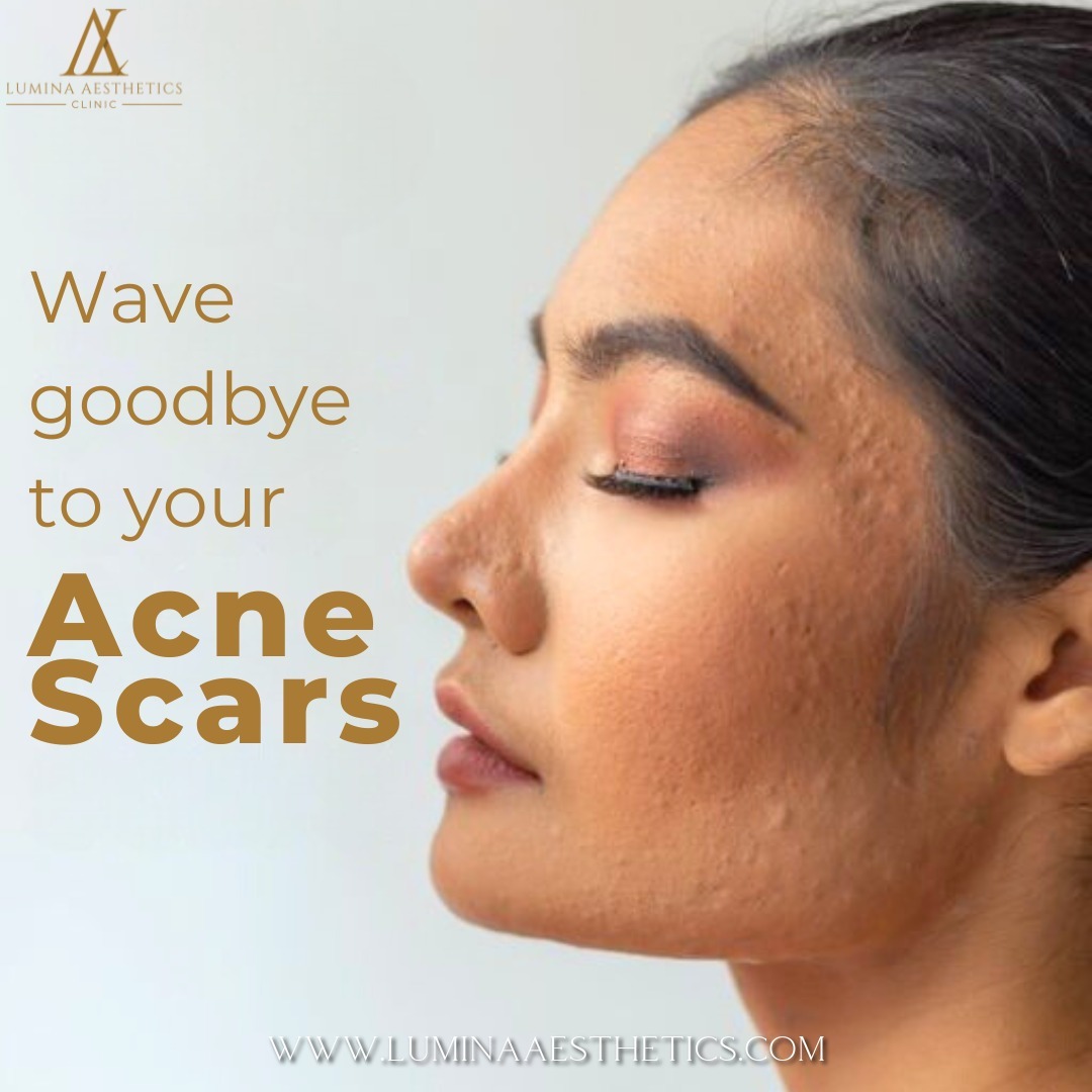 Lumina Aesthetics Bali Facebook ad