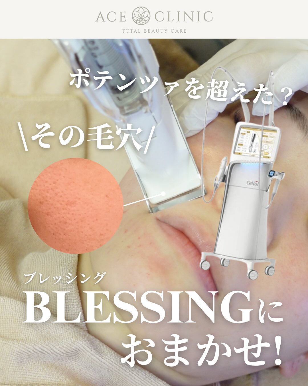 ace.clinic.osakaumeda Facebook ad