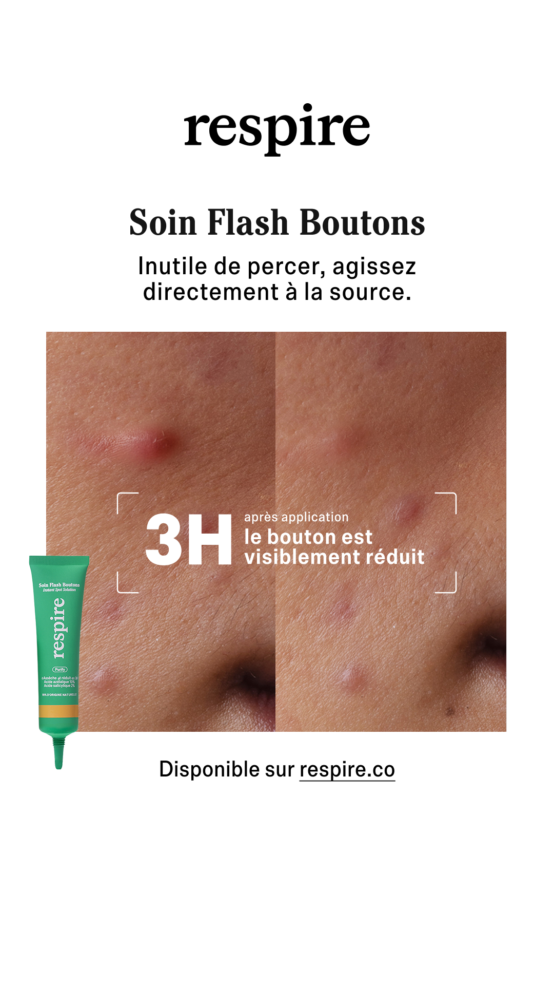 Respire Facebook ad