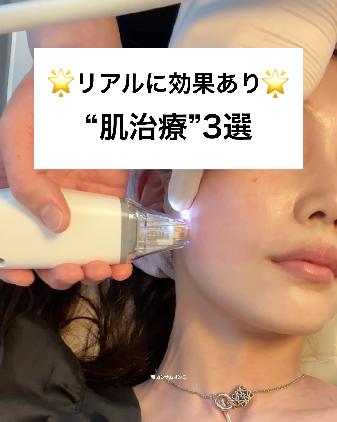 カンナムオンニ Facebook ad