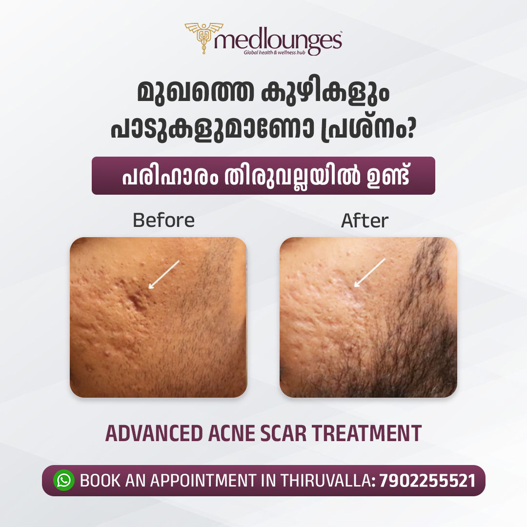 Medlounges Aesthetics Facebook ad