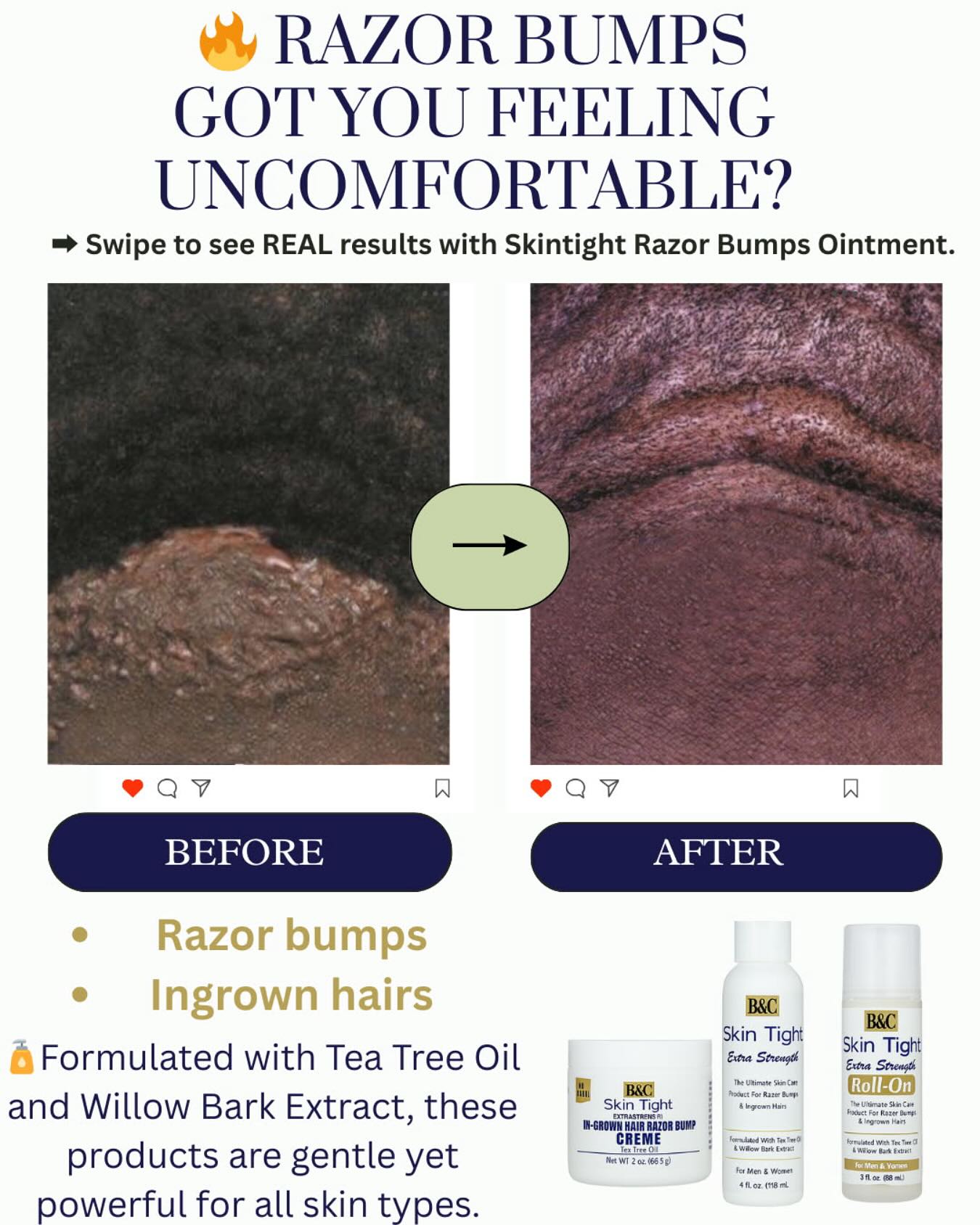 Skin Tight Facebook ad: The difference is clear: before and after ingrown…