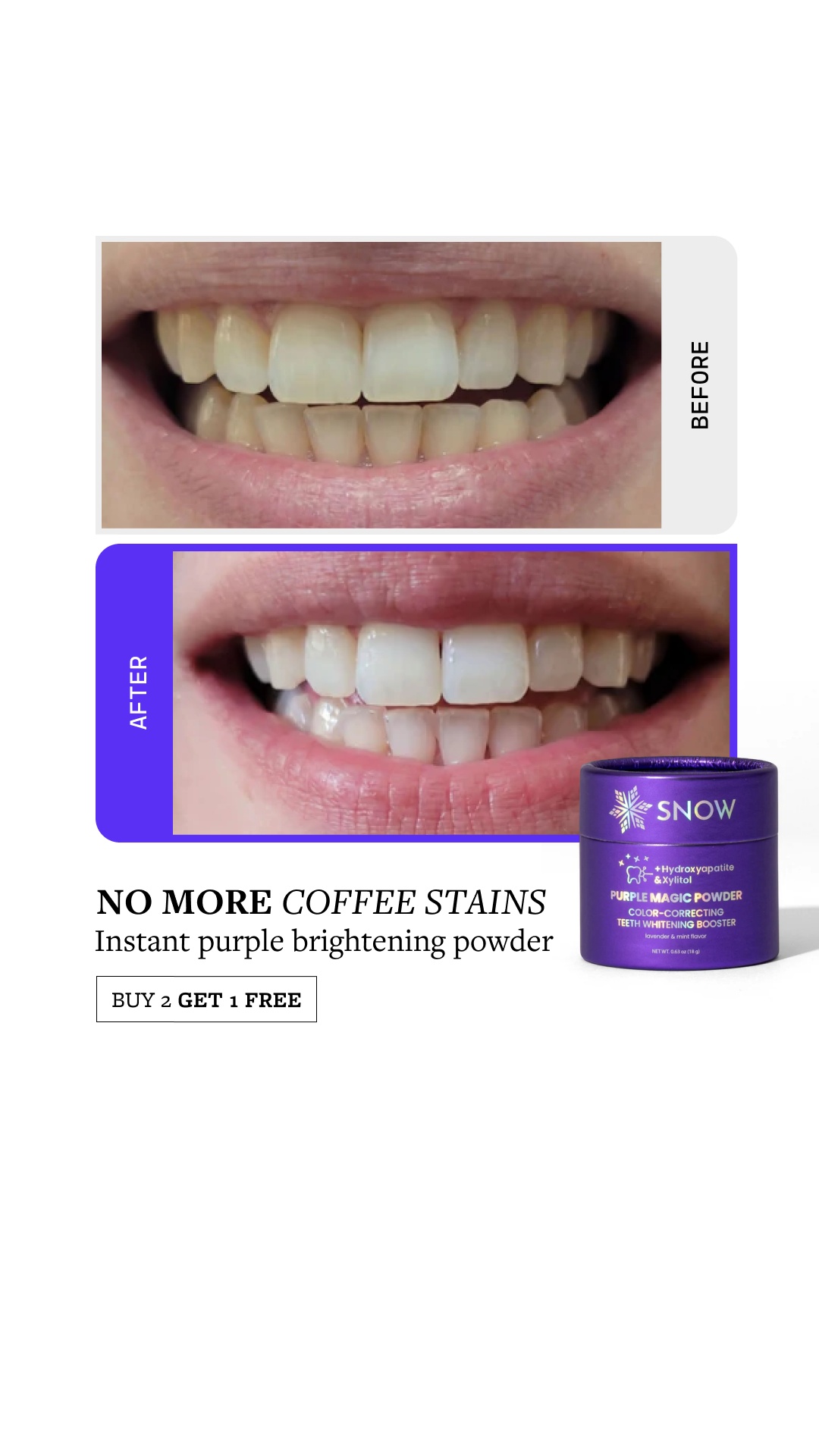 SNOW Teeth Whitening Facebook ad