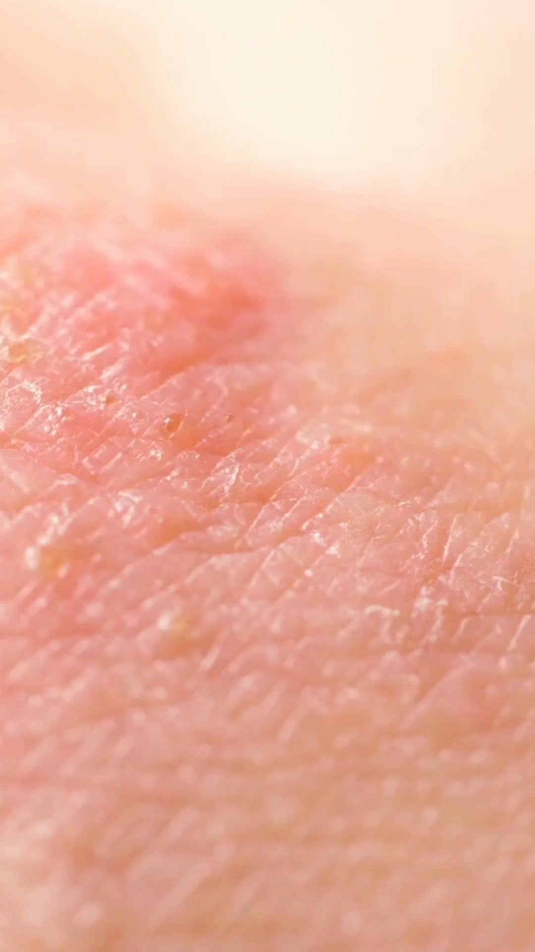 Azienda Agricola Dieghito Facebook ad: Il cortisone non basta più? Prova il naturale