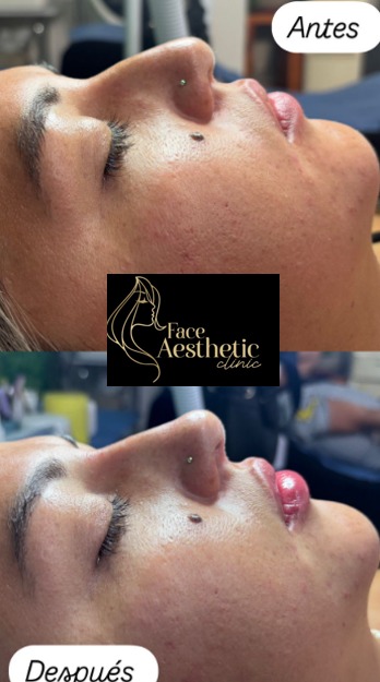 Aesthetiic Cliniic Facebook ad: ARMONIZACIONES FACIALES