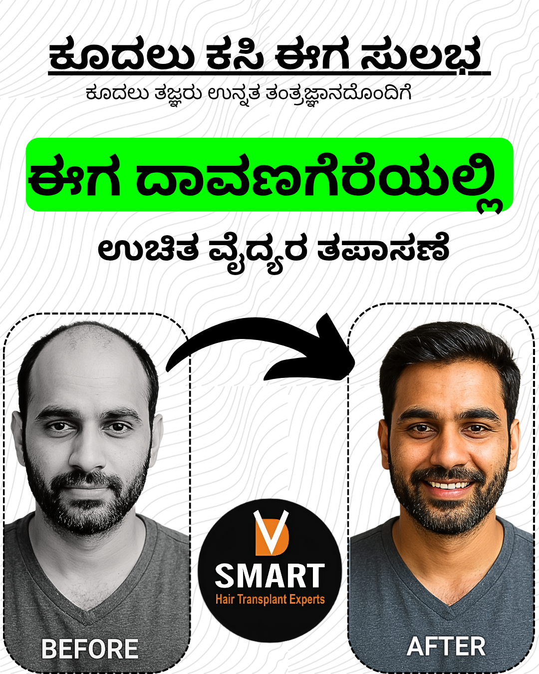 V-Smart Hair Transplant & Skin Solutions Facebook ad
