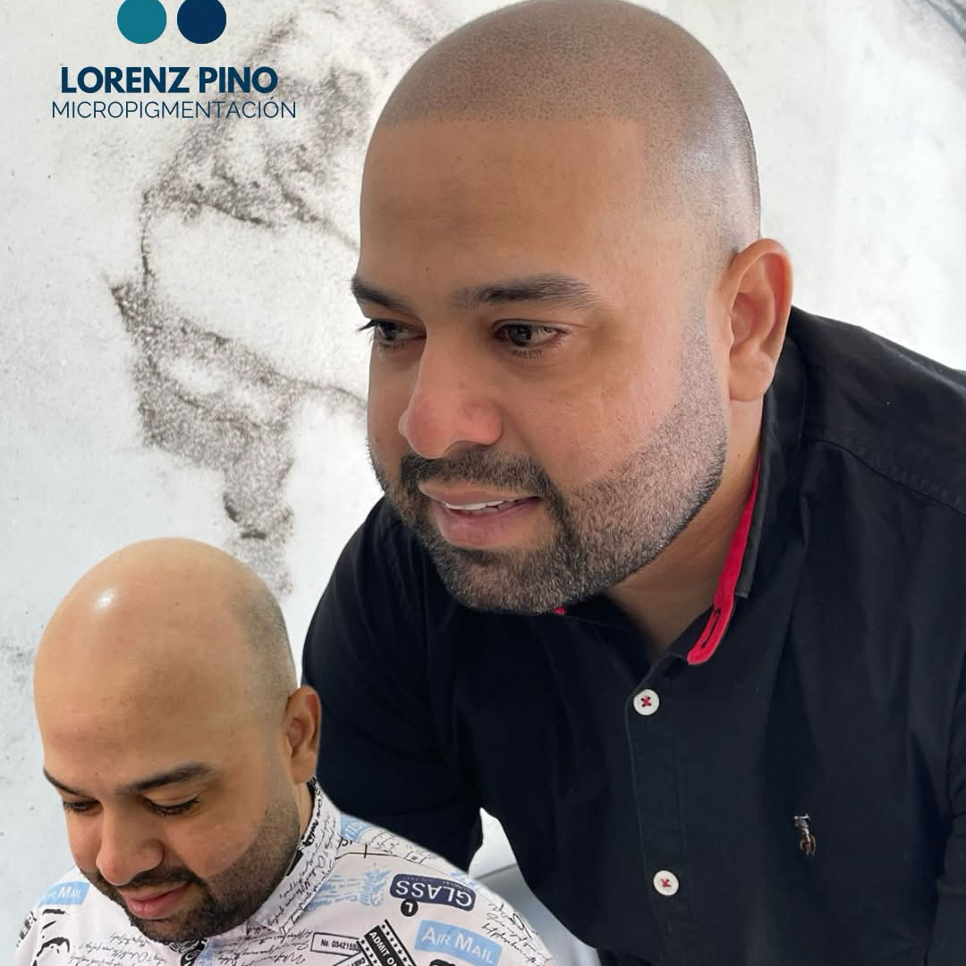 Lorenz Pino Facebook ad: Consulta!
