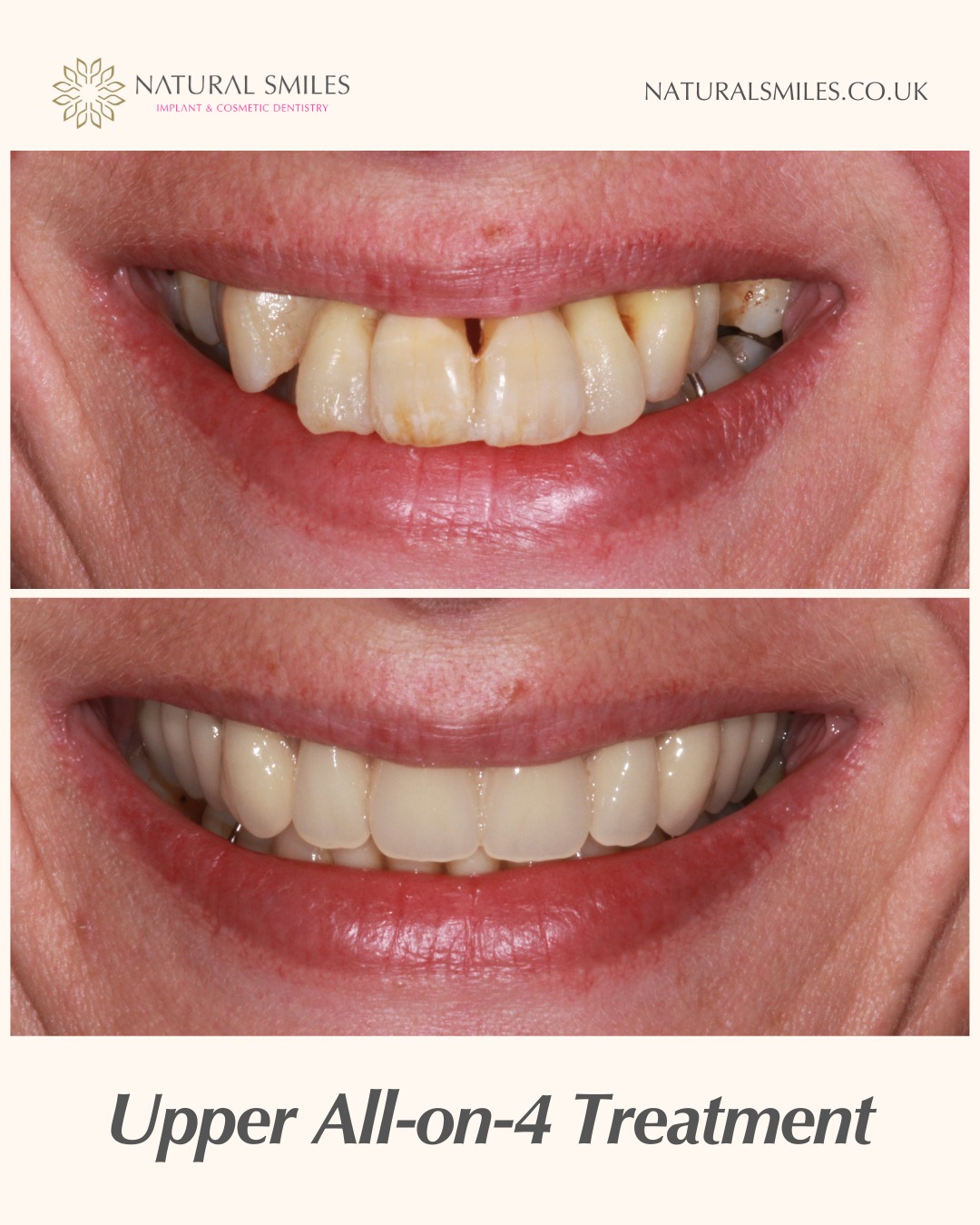 Natural Smiles Dental Facebook ad from Oct 27, 2025