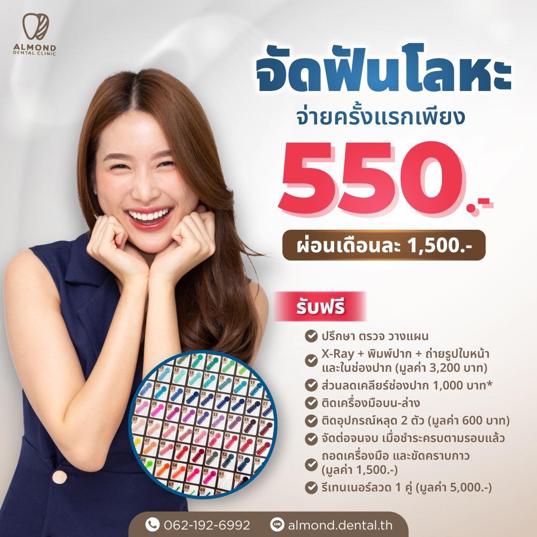 Almond Dental Clinic ถนนประชาชื่น บางซื่อ บางซ่อน Facebook ad: อยากจัดฟันเหล็ก… ยิ้มสวยมั่นใจ มาทางนี้