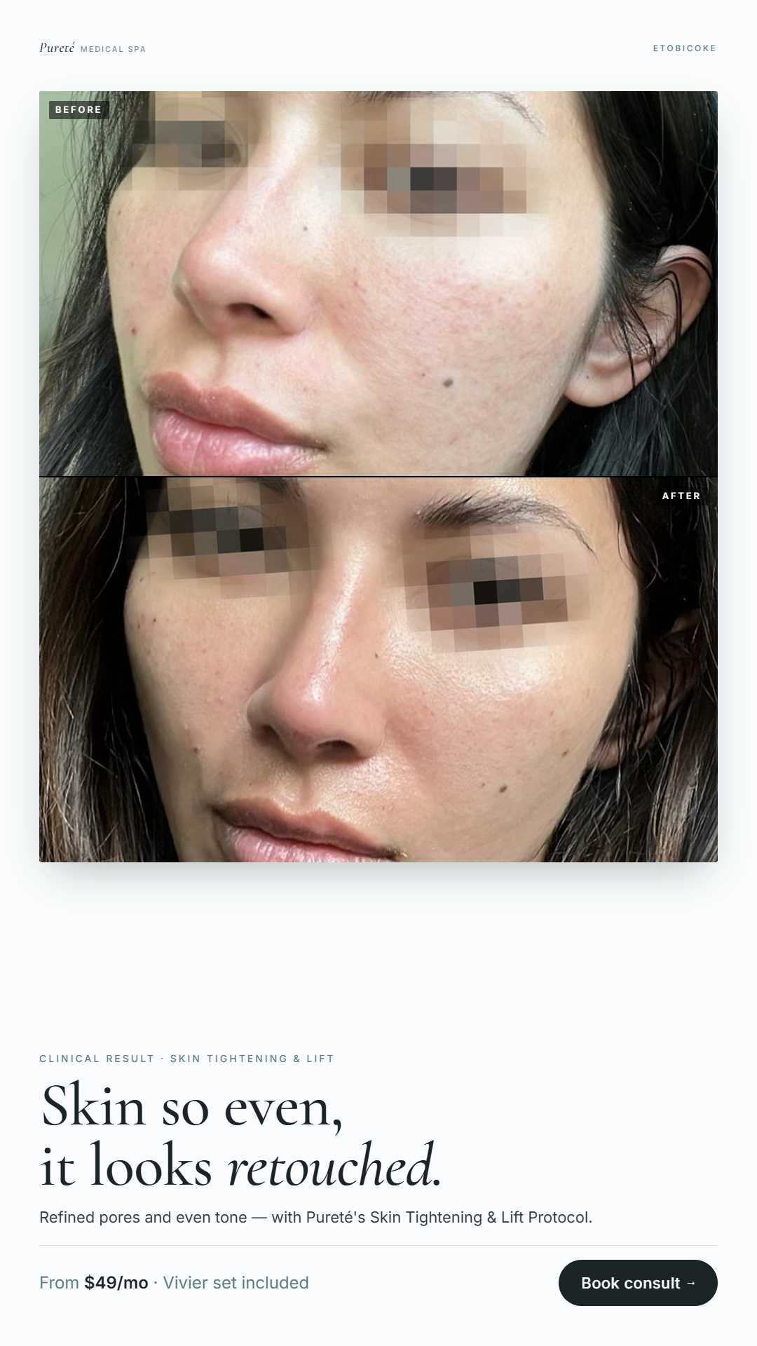 Pureté Medical Spa Facebook ad from May 10, 2026