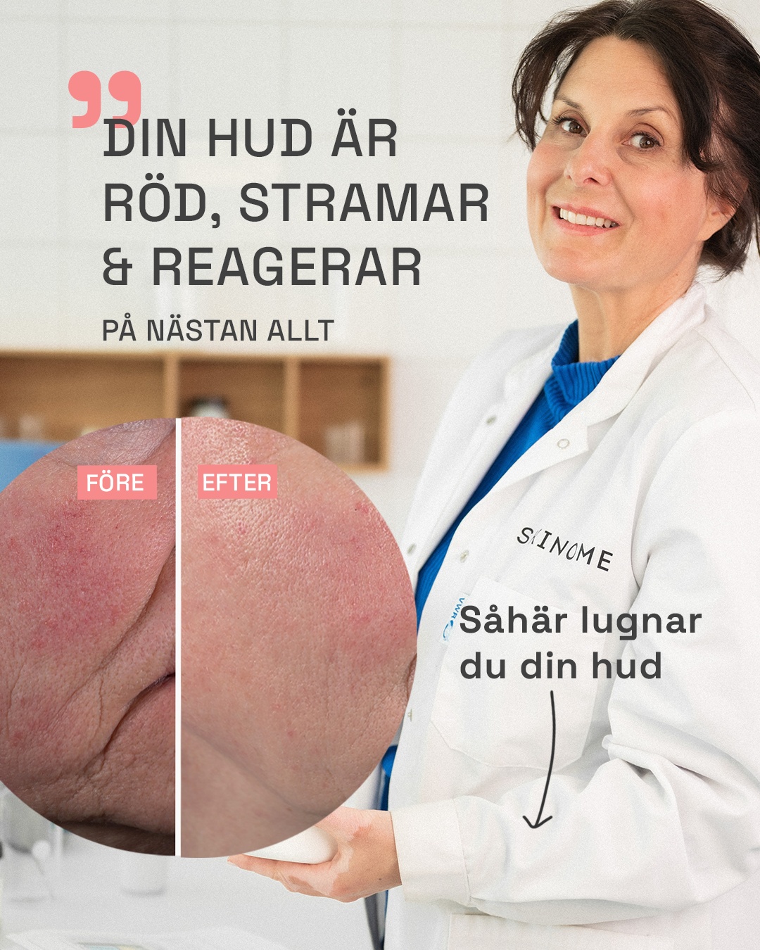 Skinome Facebook ad