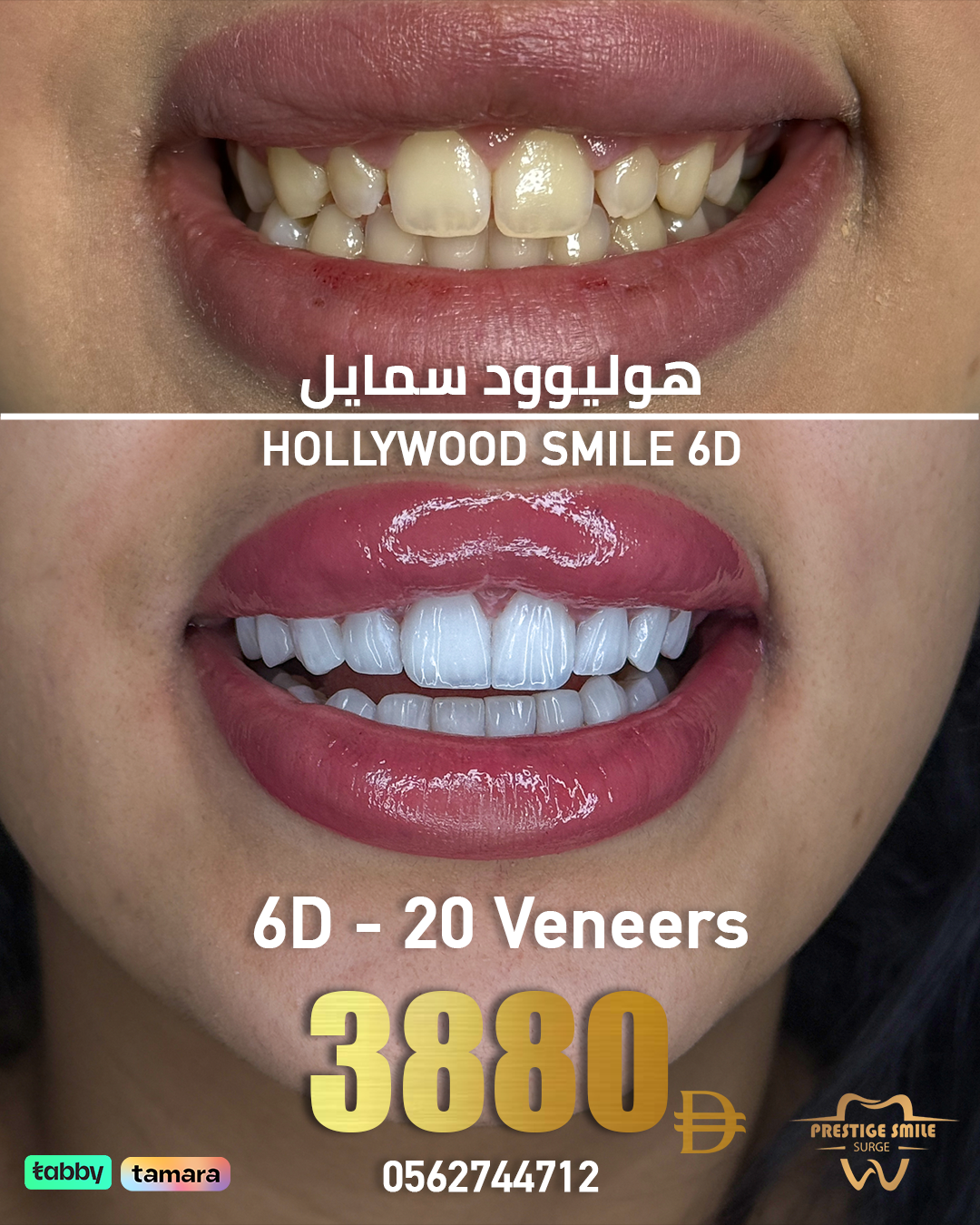 PSC Facebook ad: تمتع بابتسامة بتفاصيل و شفافية من عيادة برستيج…