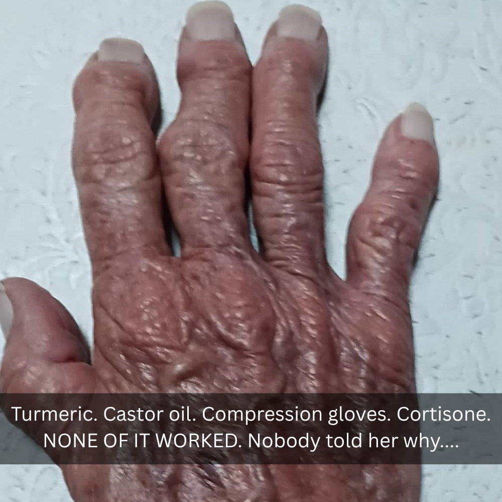 The Menopause Journal Facebook ad: Menopause did this to her hands