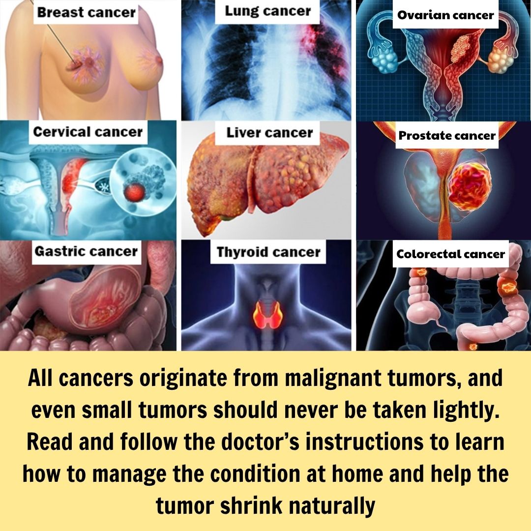 PGH-Orthopedic Surgery Department Facebook ad: Home cancer treatment method