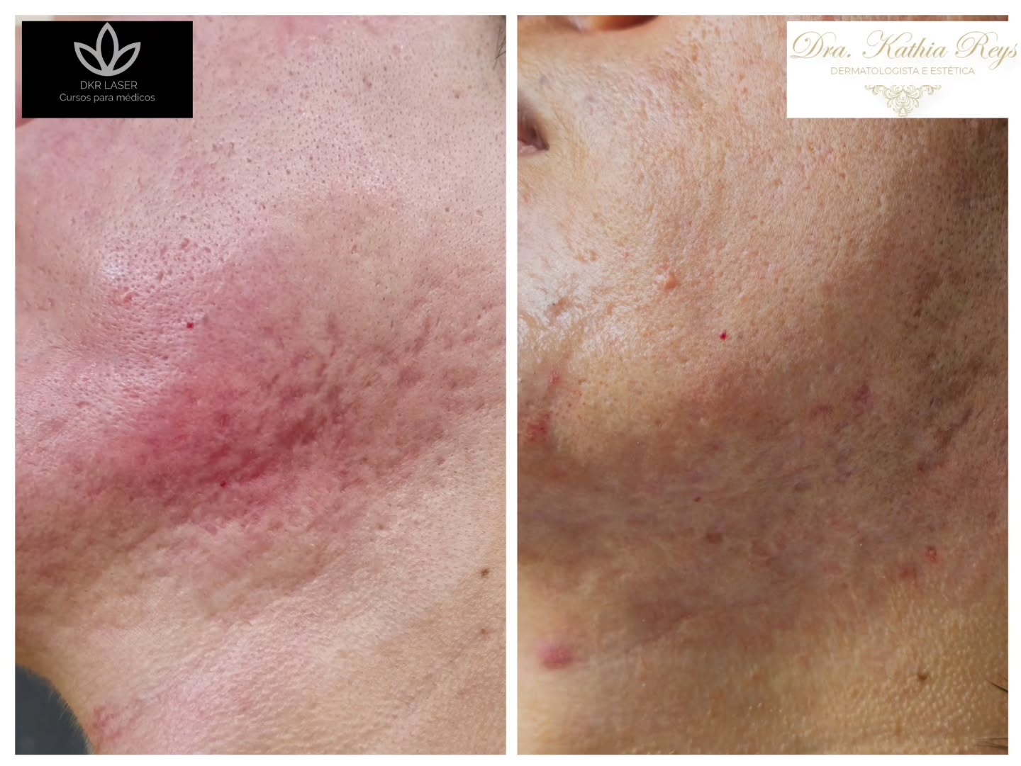 Dra Kathia Reys Dermatologista Facebook ad: Dra. Kathia Reys | Dermatologista…