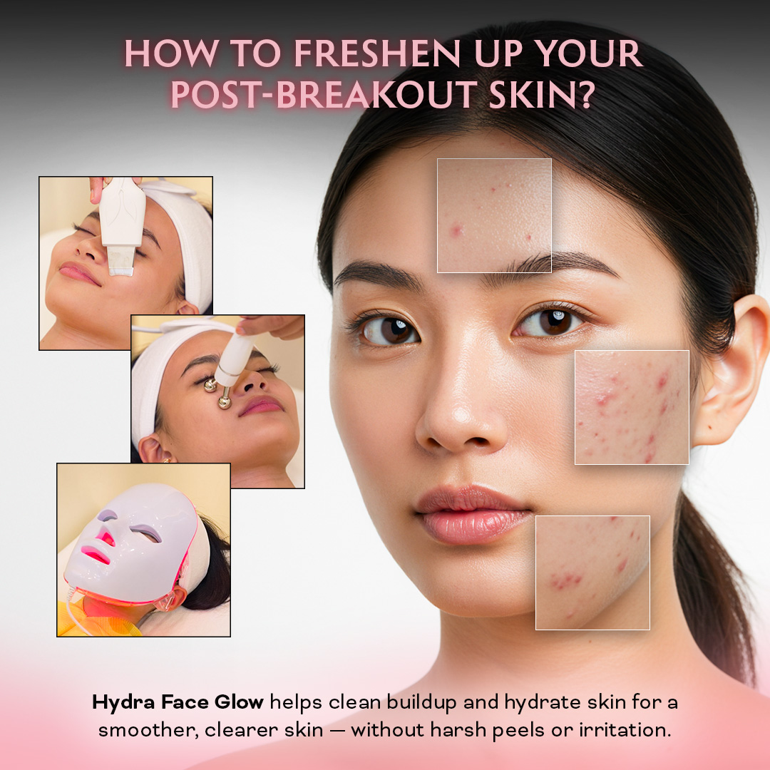 Venofye Aesthetics Cebu Facebook ad: Chat with us