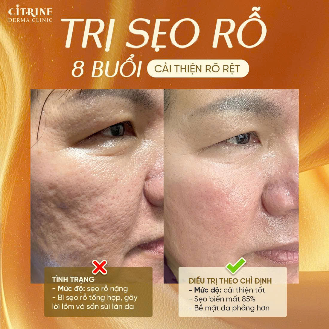 Phòng Khám Da Liễu Citrine Derma Clinic Facebook ad