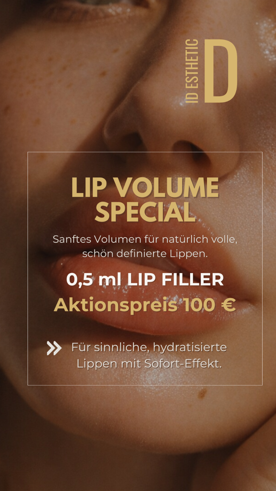 ID Esthetic Facebook ad