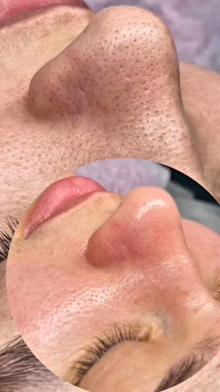 Estética integral Facebook ad: OPORTUNIDAD POR 24HS