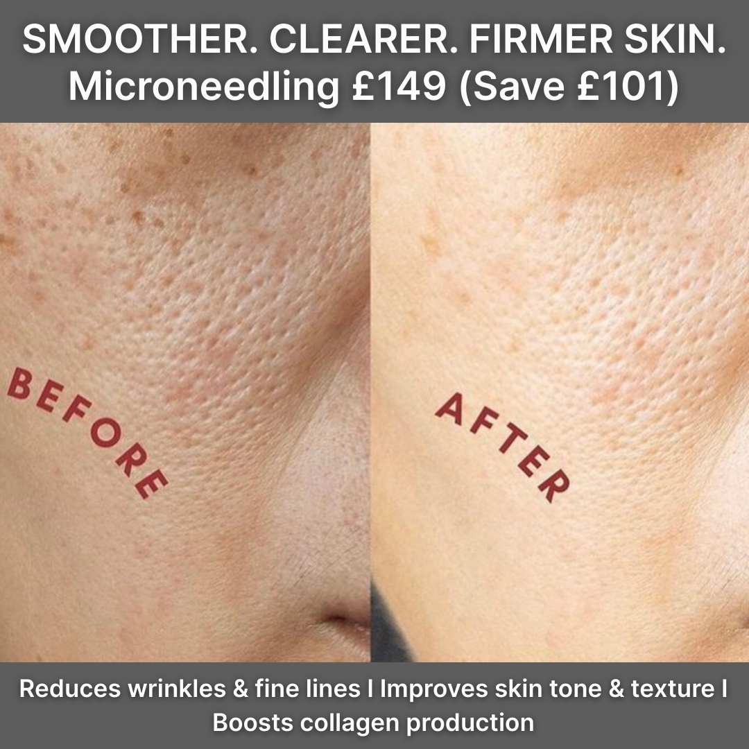 Salon House Facebook ad: £100 Off Skin Treatment