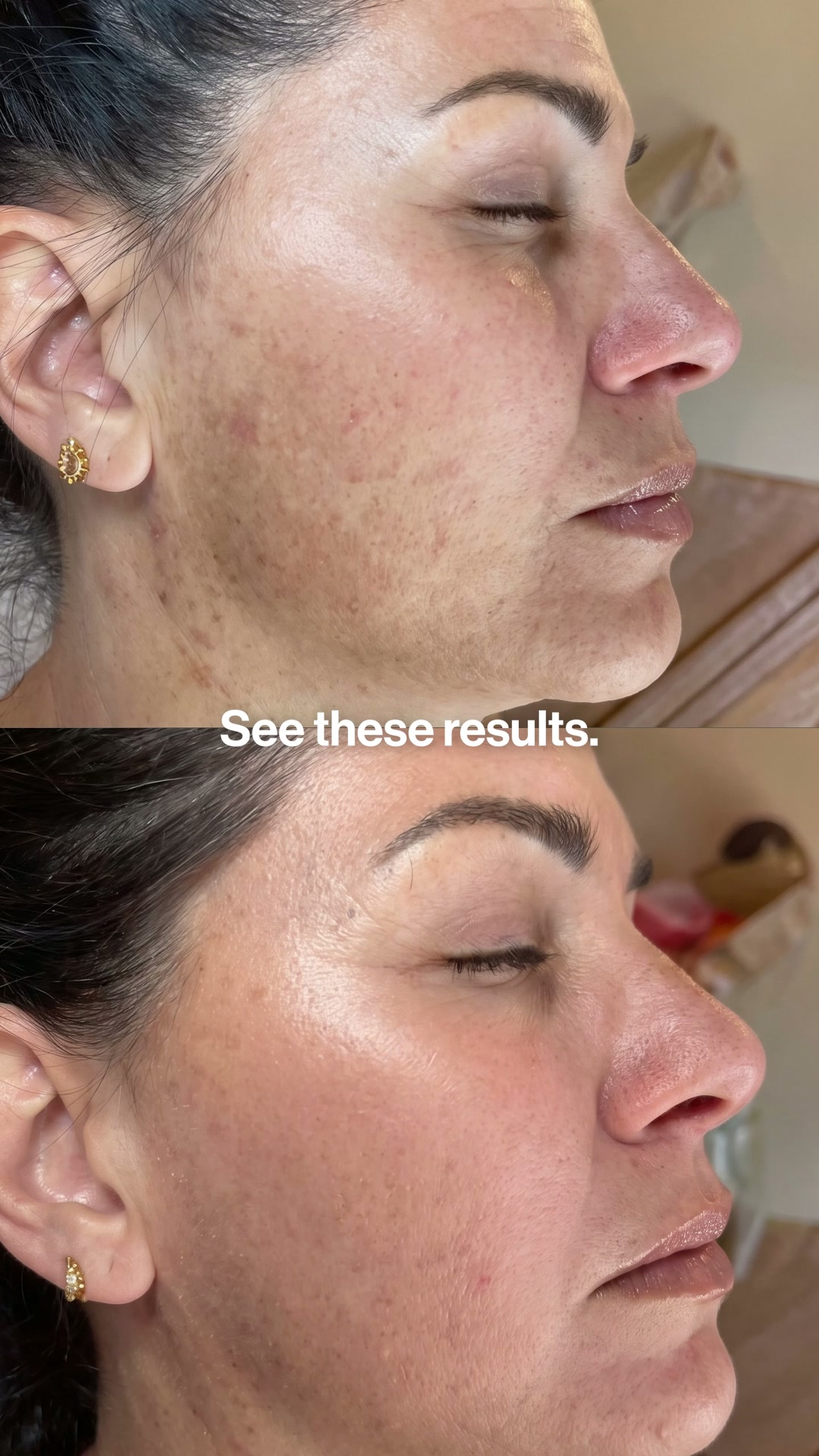 Be Bodywise - UAE Facebook ad: Fade Pigmentation. Find Your Glow