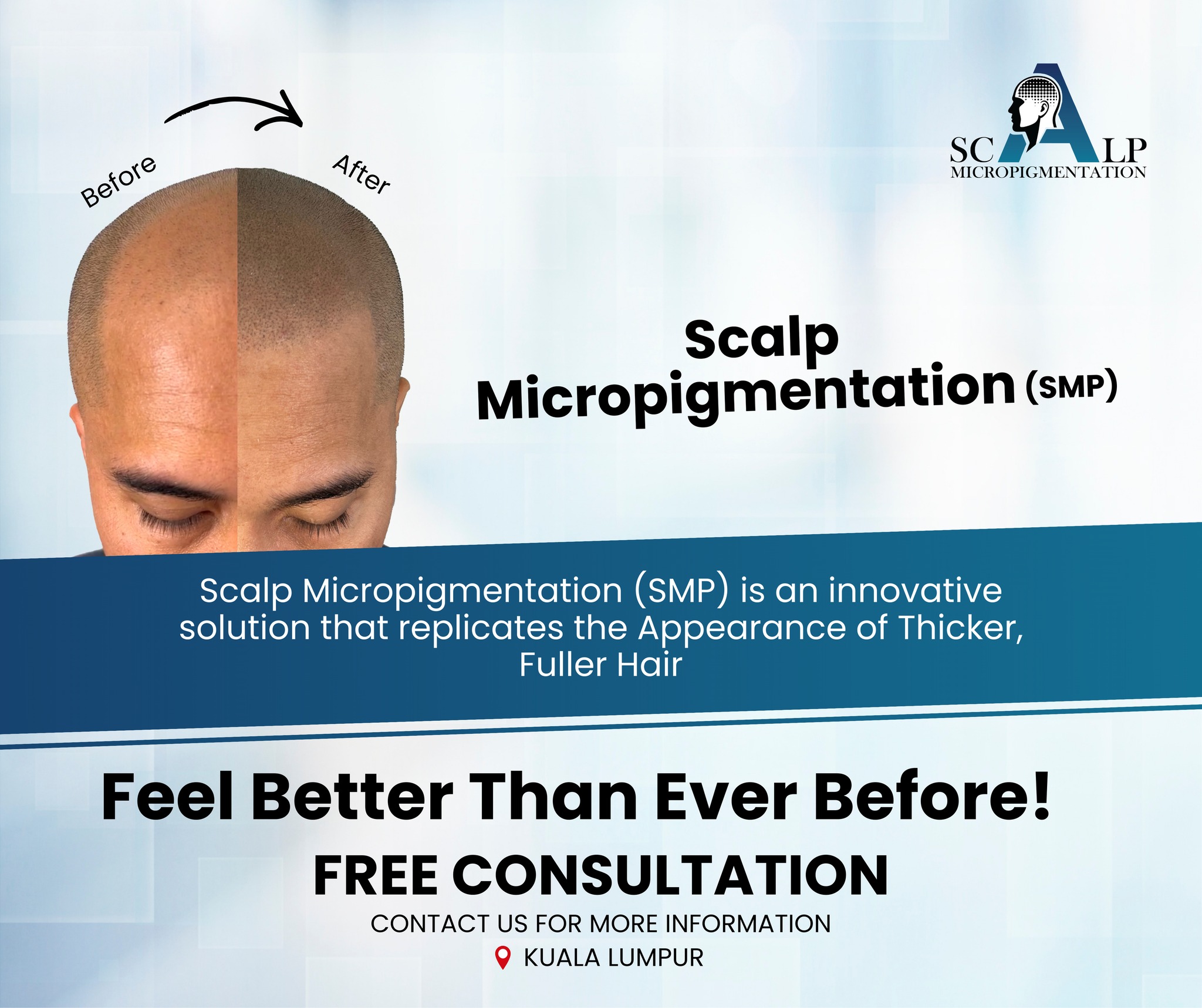 Advanced Scalp Micropigmentation Facebook ad: Feel Confident Again with Scalp Micropigmentation (SMP)