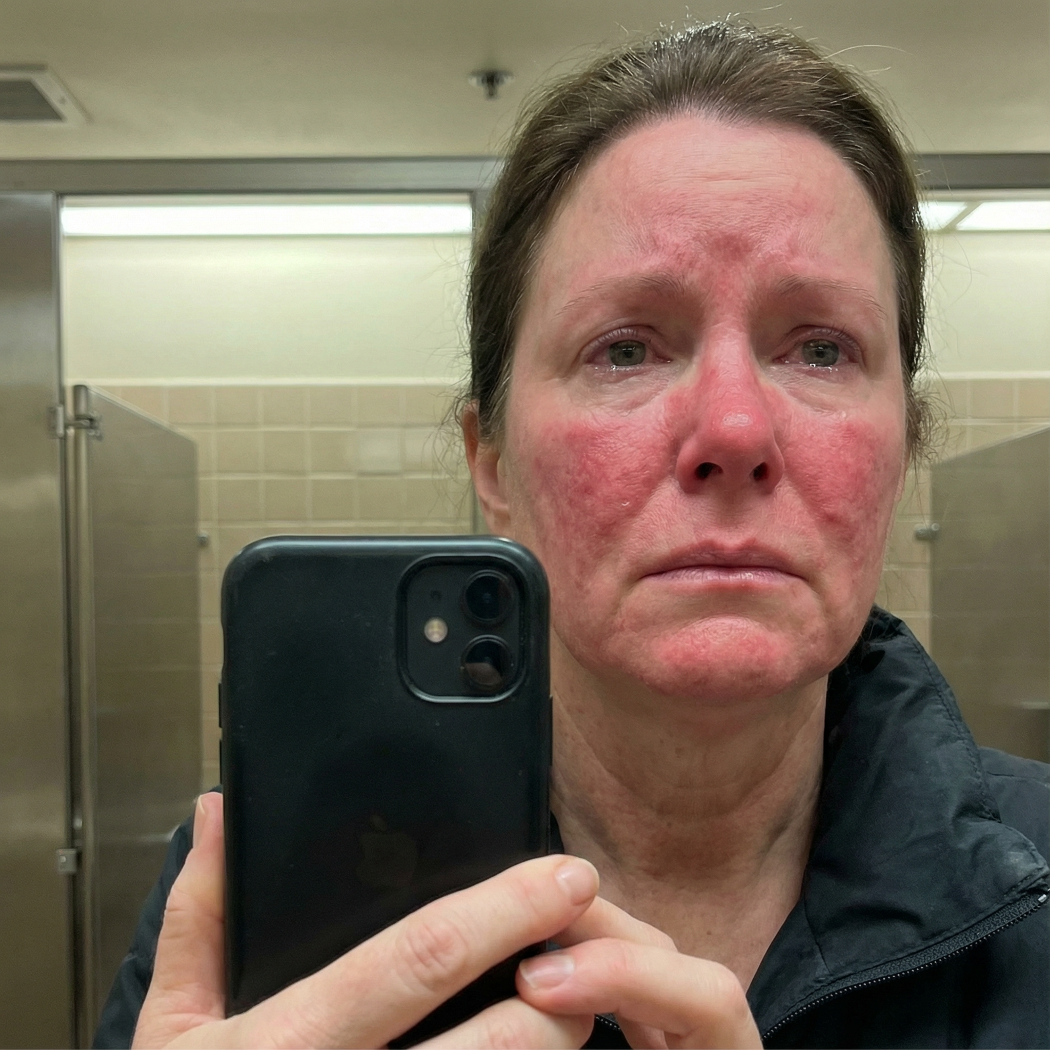 Sarah Mitchell Facebook ad: My Rosacea Got Too Much - Here's How I Turned a Corner