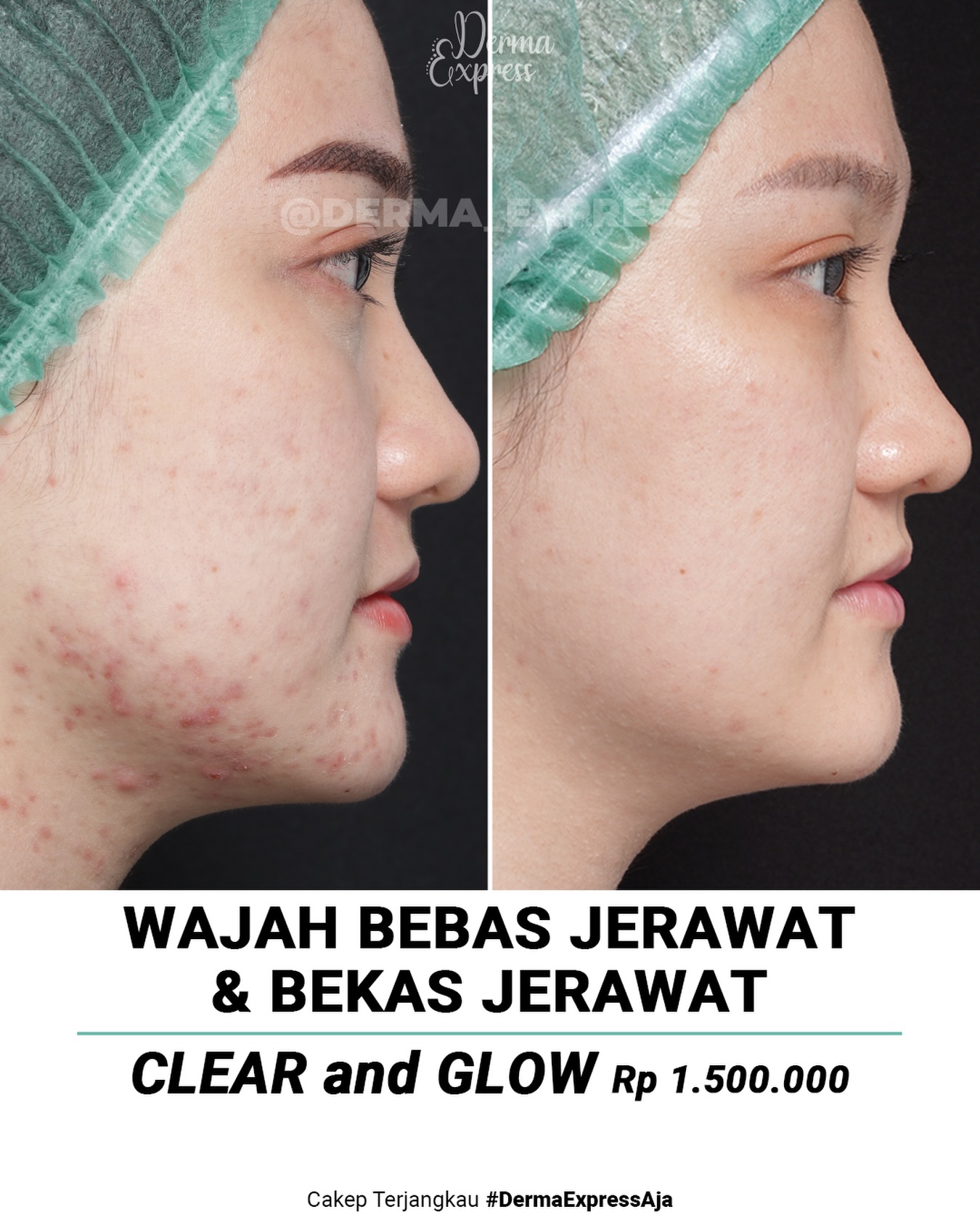 derma_express Facebook ad