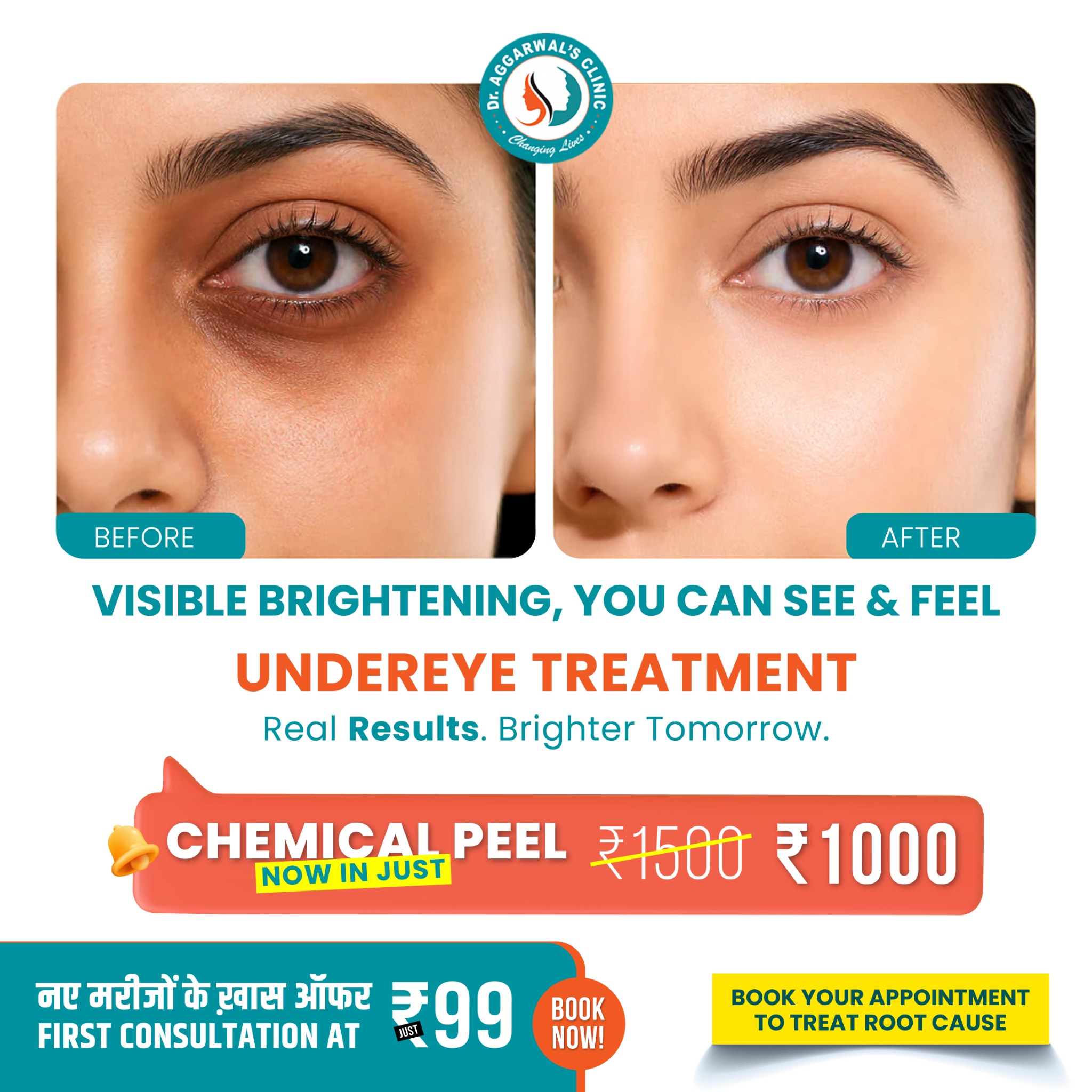 Dr aggarwals hair transplant, laser treatment, cosmetic & dental center Facebook ad