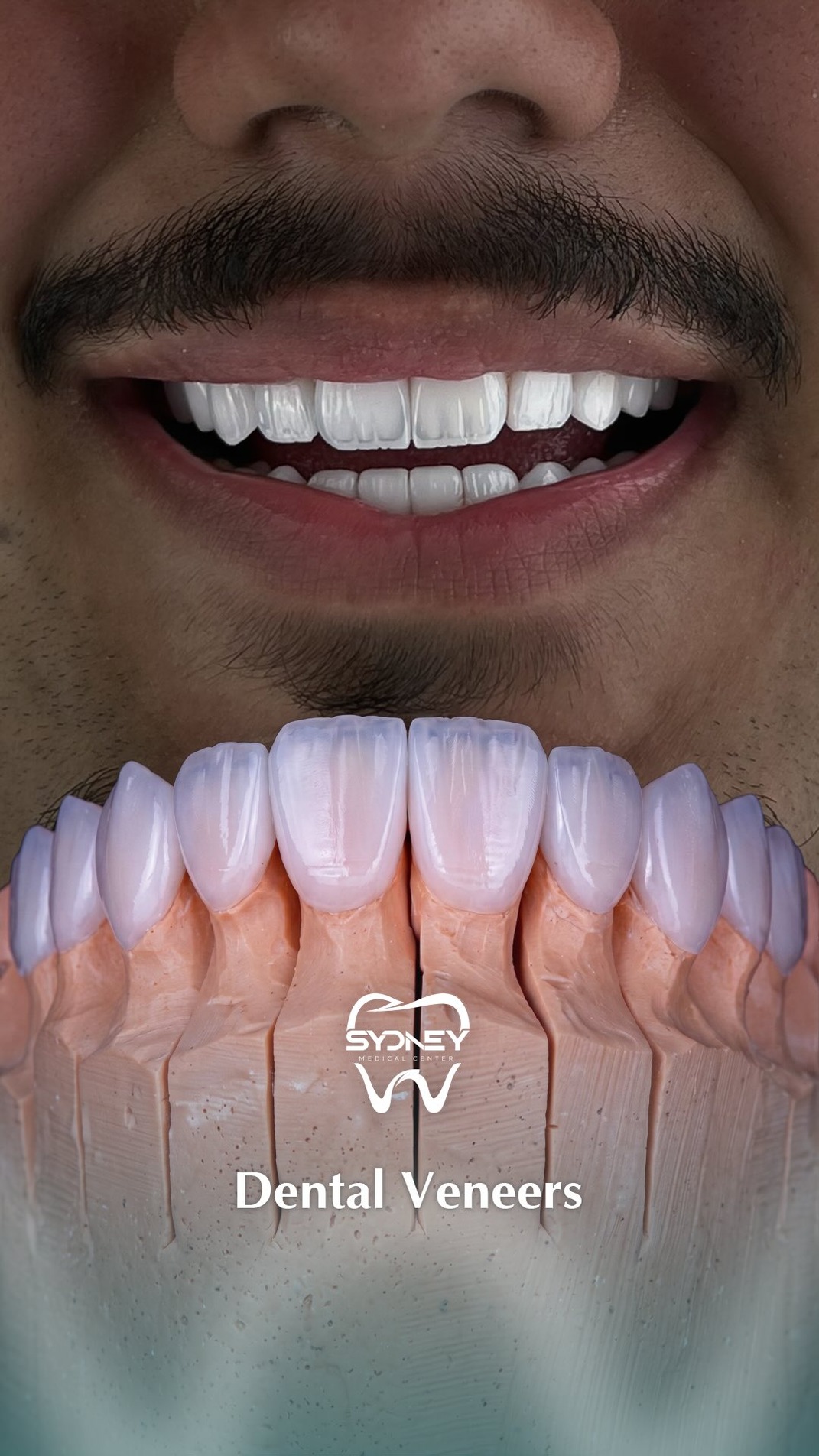Sydney Dental Facebook ad: فينير الأسنان