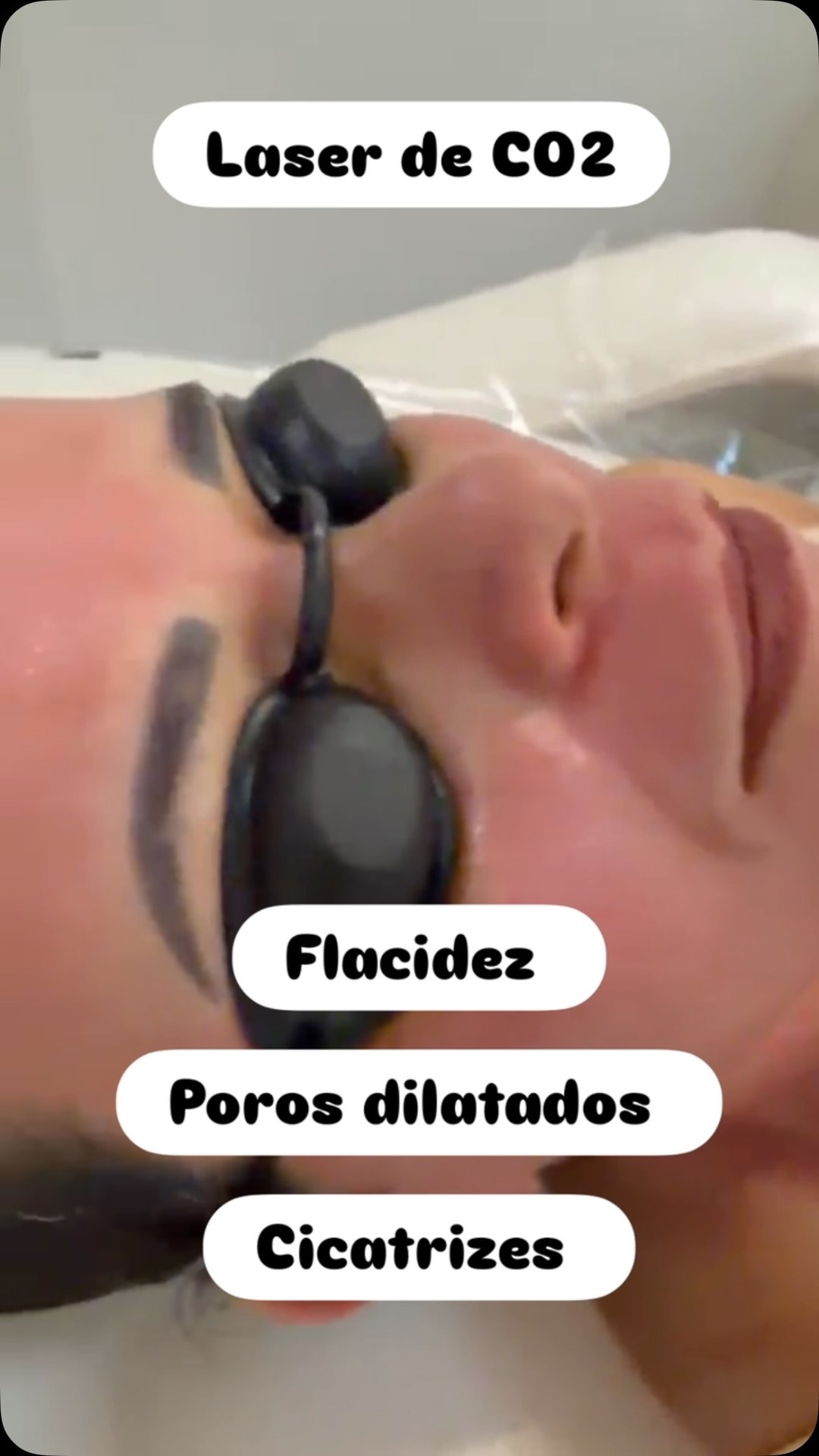 Clinica BodyDepil Portugal Facebook ad from Jun 20, 2026
