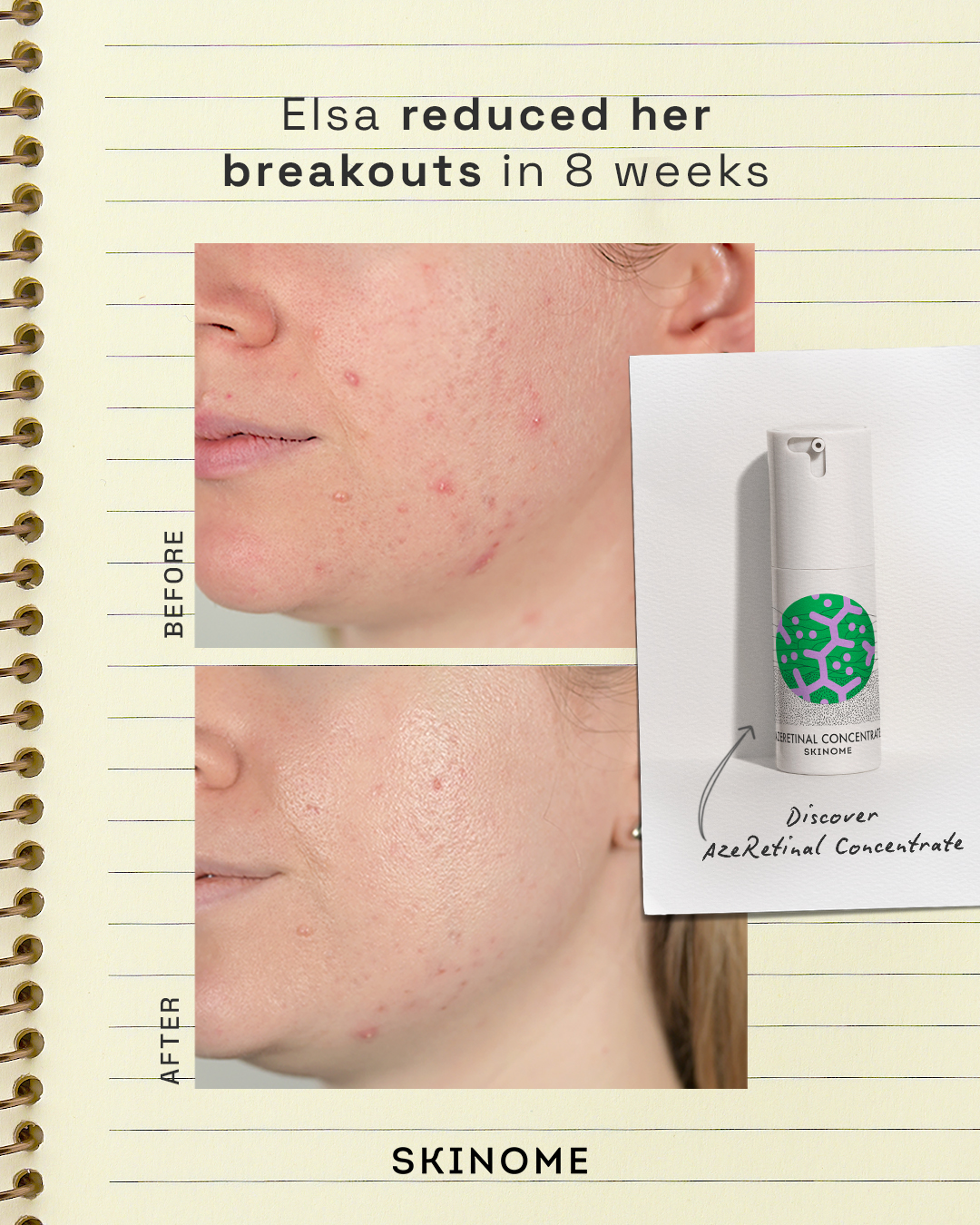 Skinome Facebook ad
