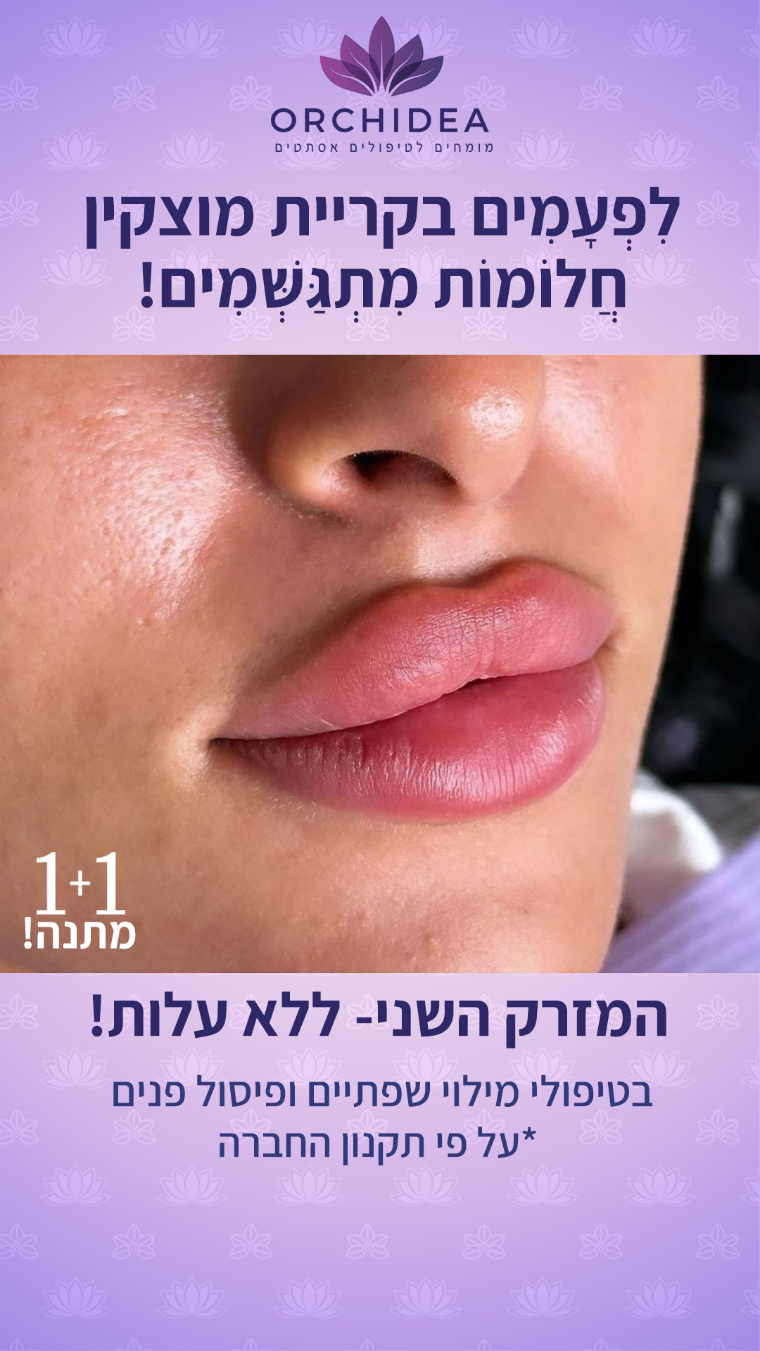 אורכידאה - רשת הקליניקות של המומחים לאסתטיקה רפואית Orchidea Facebook ad