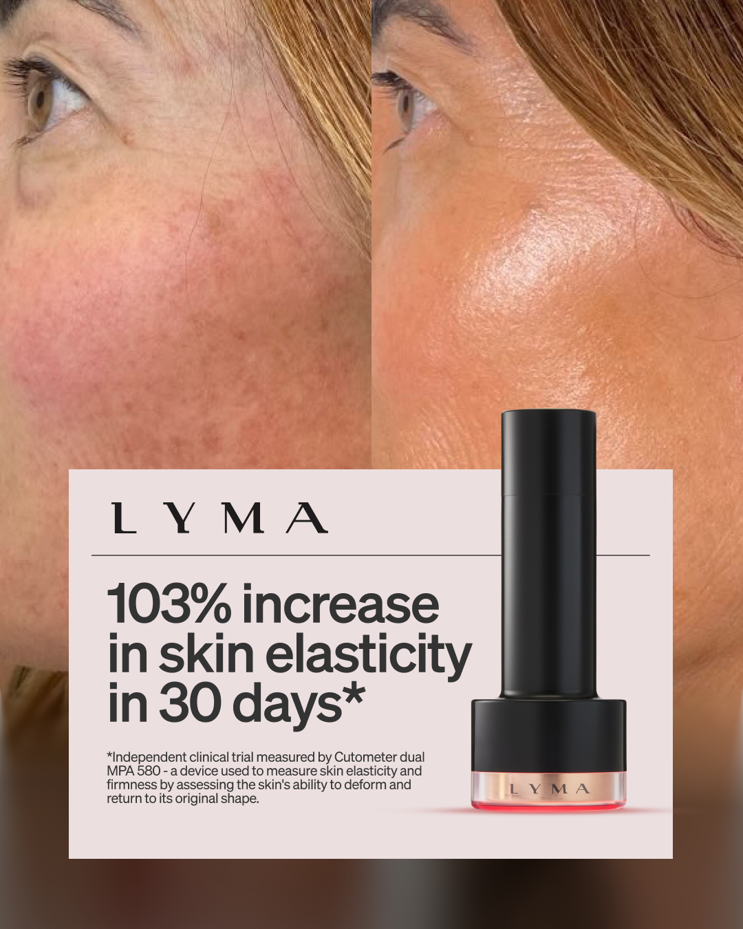 LYMA Facebook ad