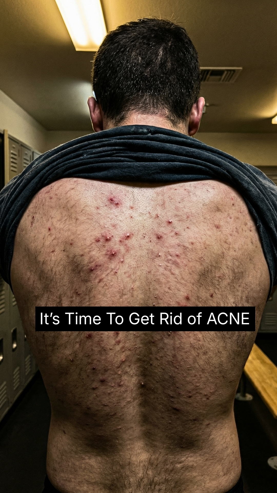 Frasé Skin Facebook ad