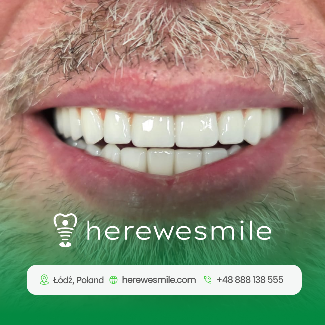 Herewesmile Facebook ad from Mar 30, 2026