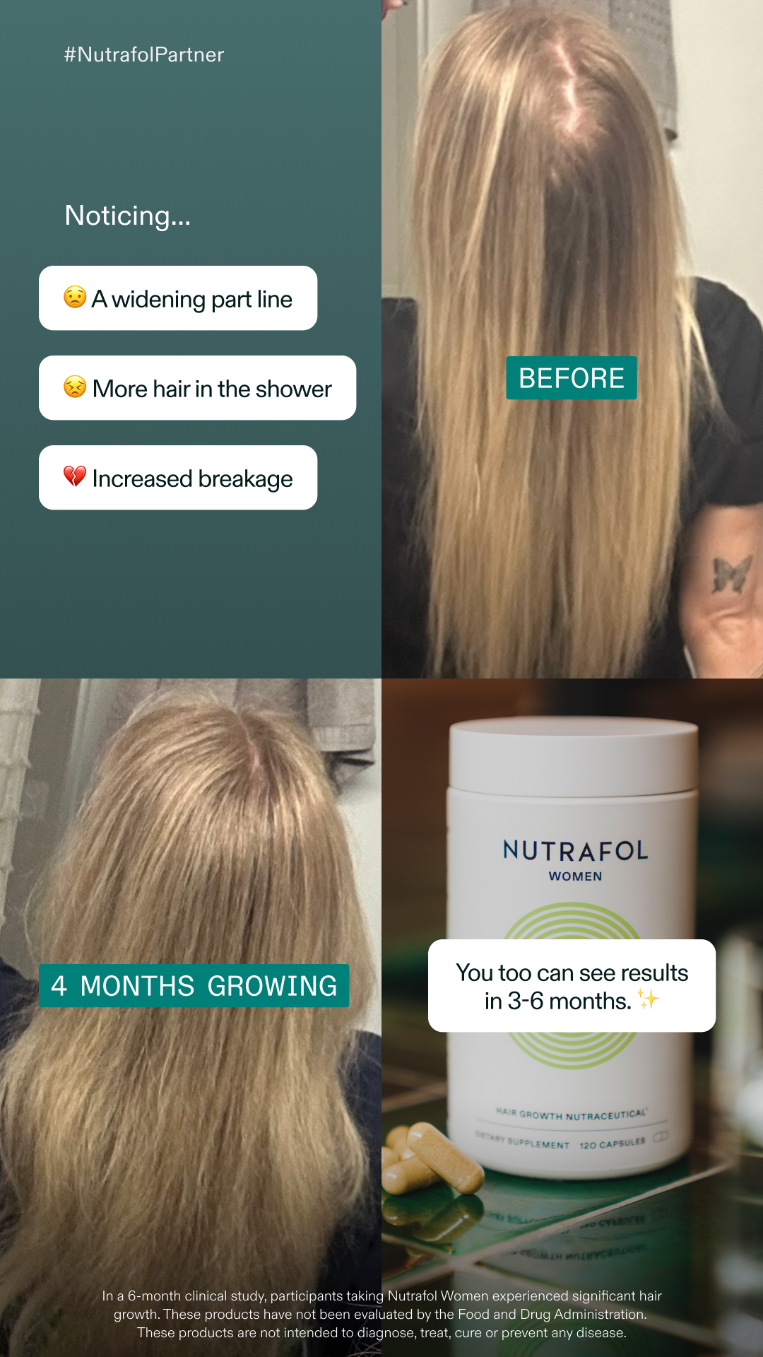 Nutrafol Facebook ad