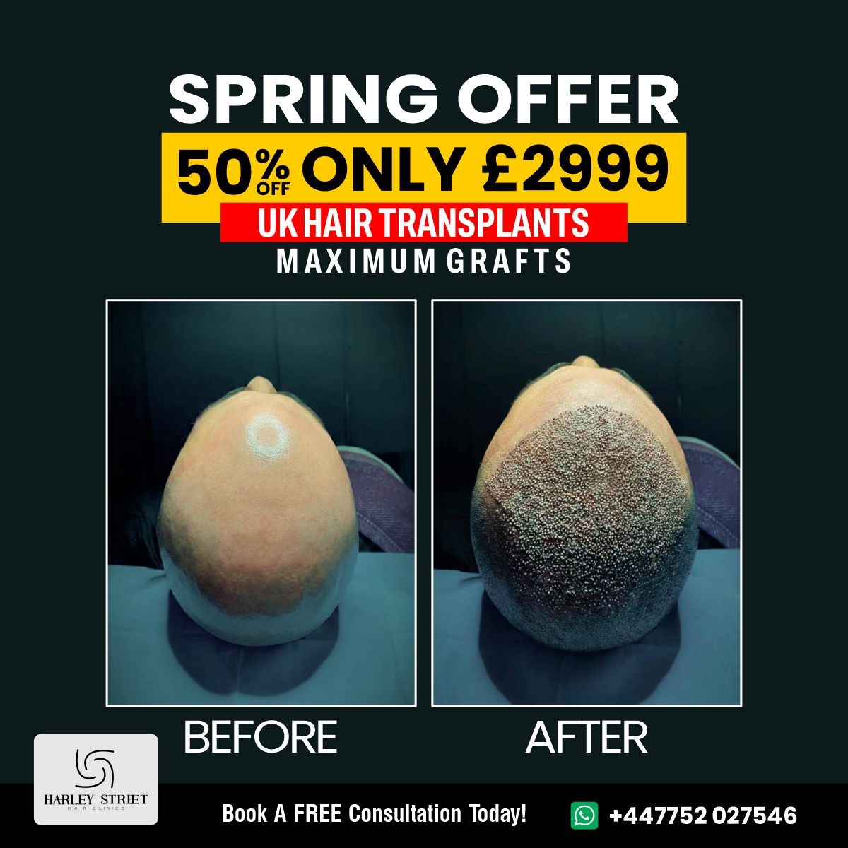 Harley Street Hair Clinics Facebook ad