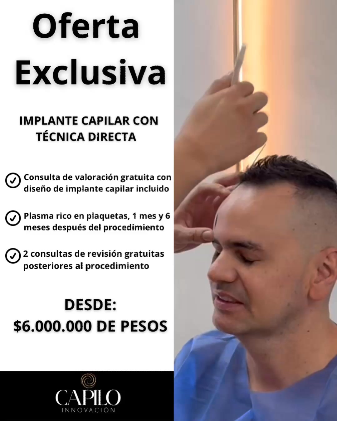 Capilo Innovación Facebook ad: OFERTA IMPLANTE