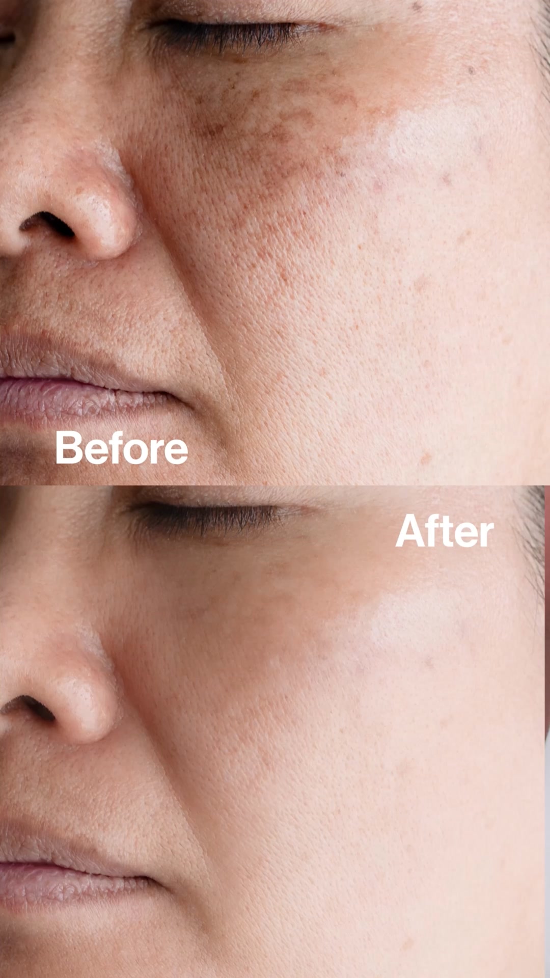 Be Bodywise AE Facebook ad: Fade Pigmentation. Find Your Glow