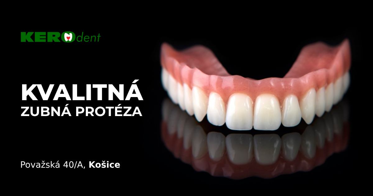 KEROdent Facebook ad: Hľadáte ambulanciu, ktorá Vám vyhotoví peknú a prirodzenú…