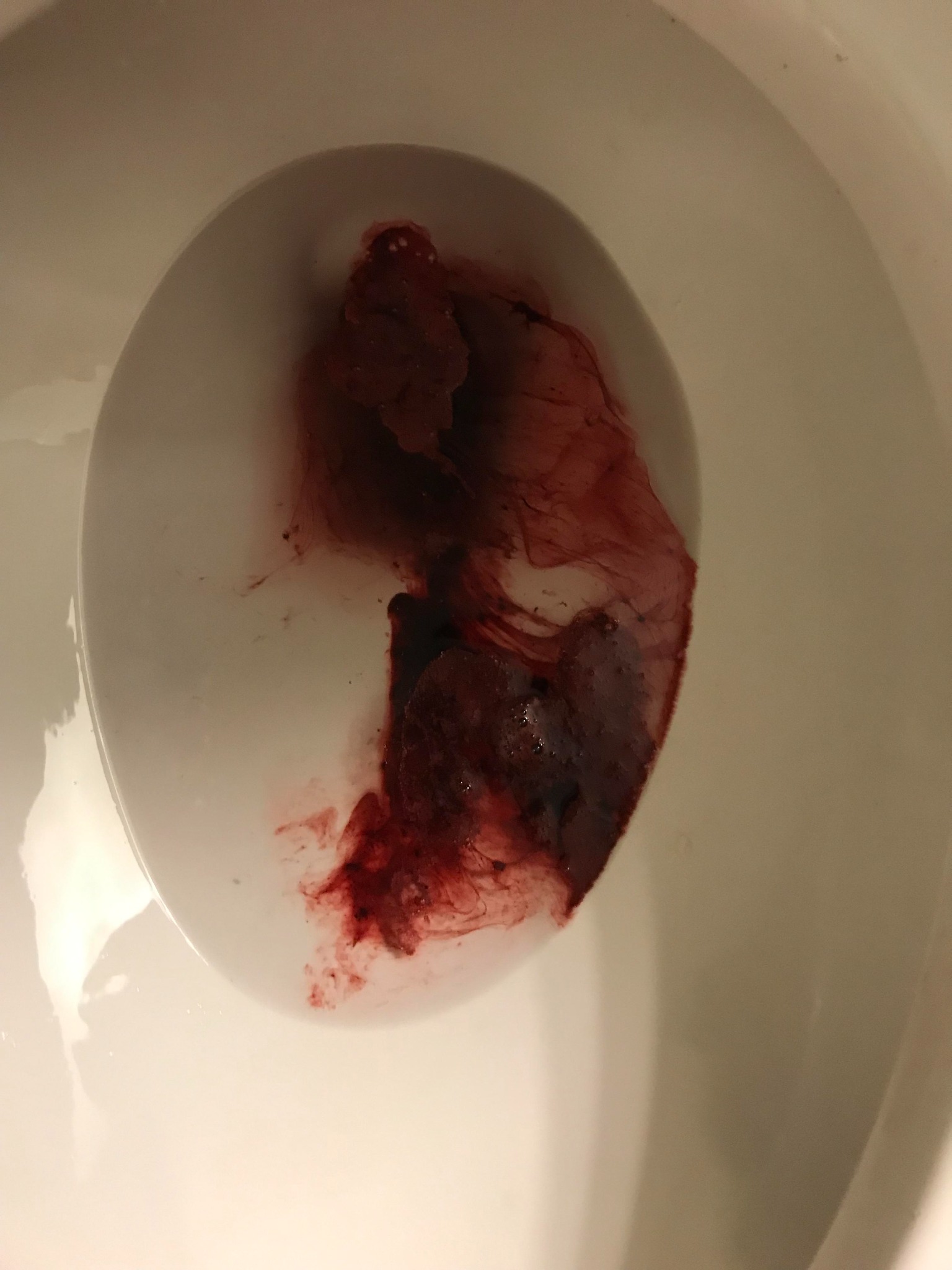 Amanda Kirsten Facebook ad: I Collapsed at a Bar Vomiting Blood.