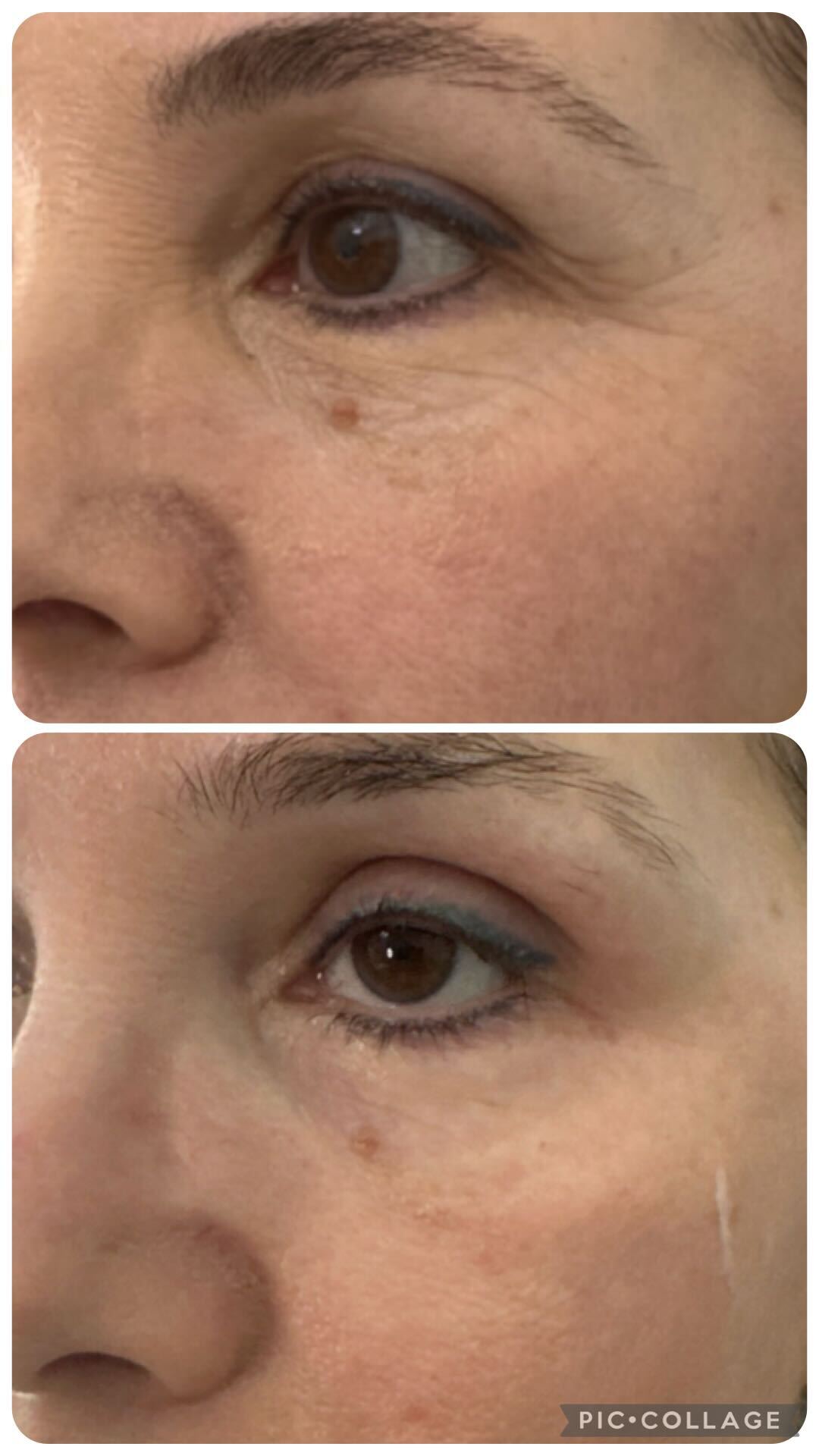 True You Skin Clinics Facebook ad