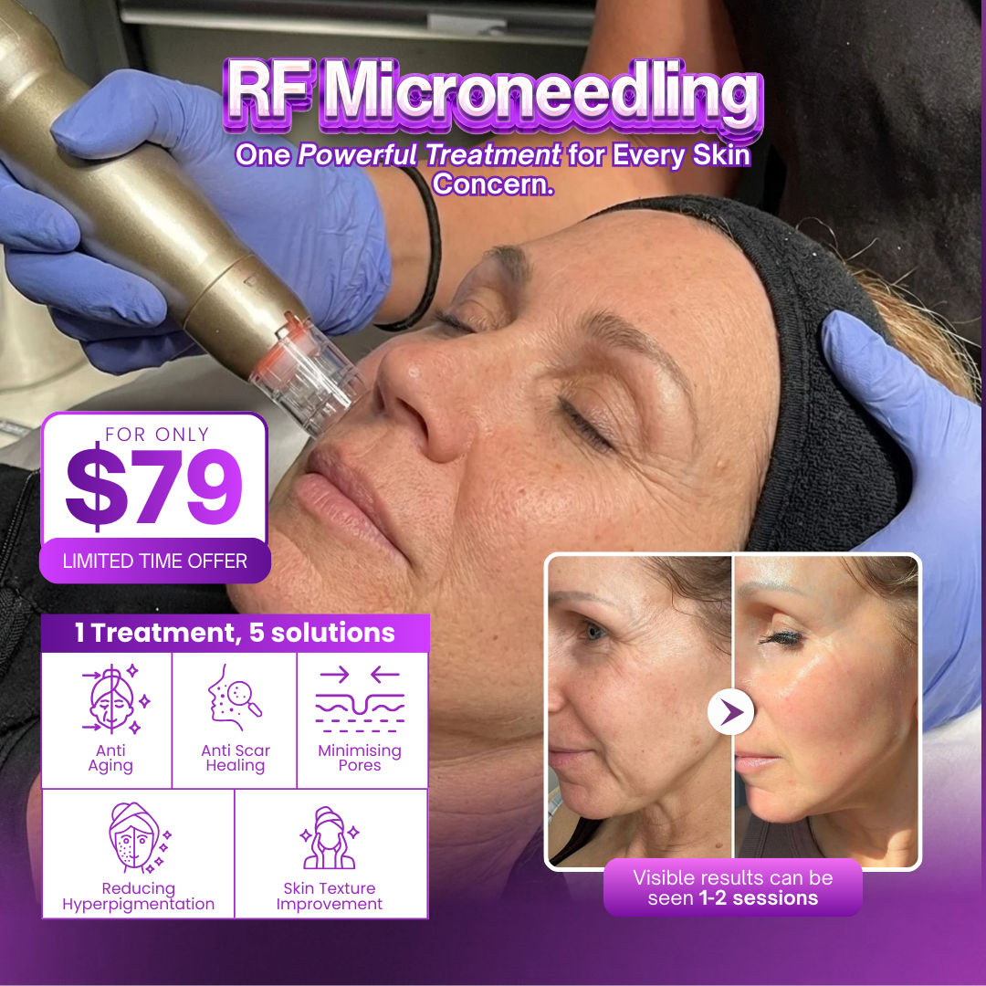 I Love Skin Treatments Facebook ad