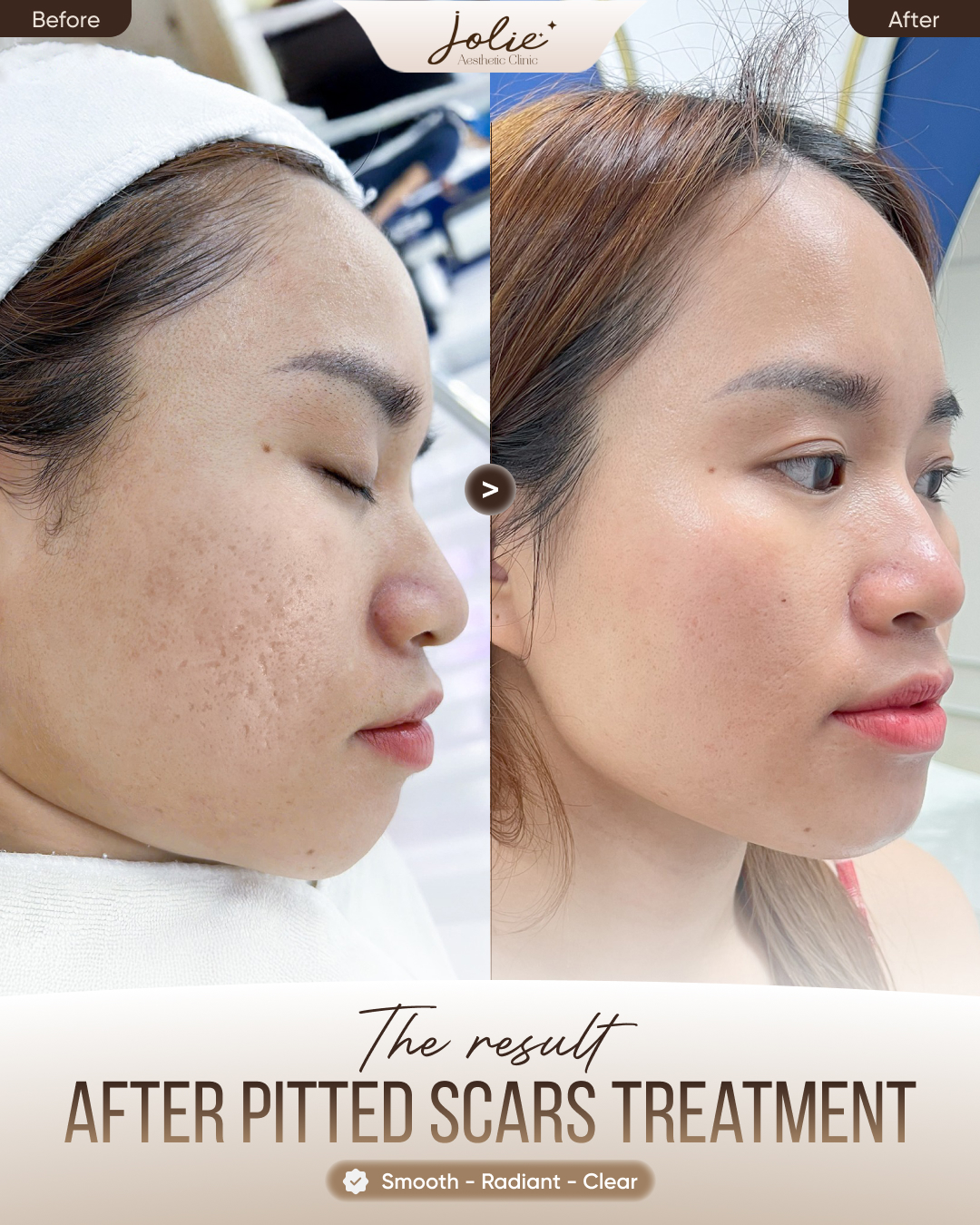 Jolie Beauty Skin Facebook ad: Instagram