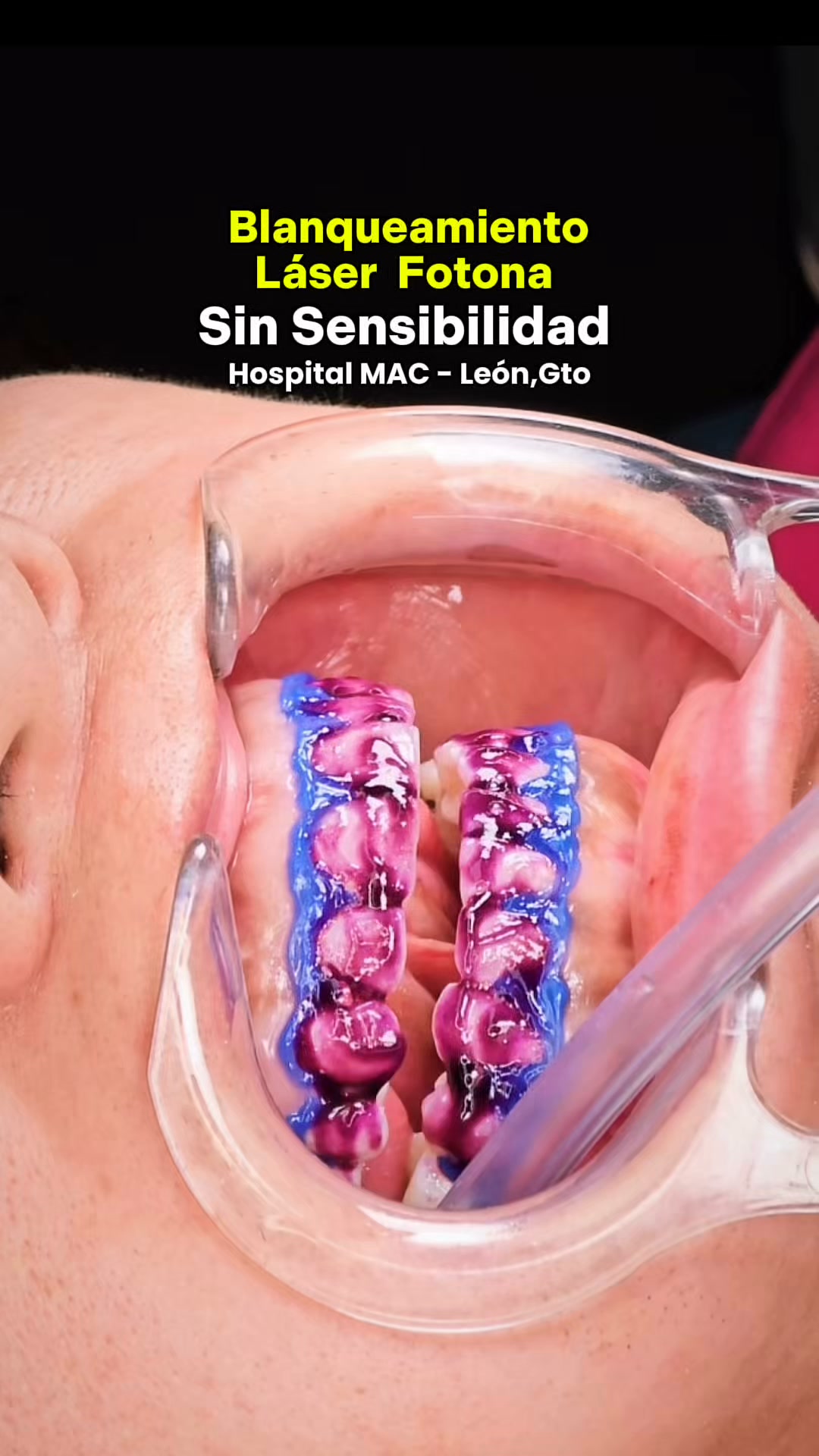 Dentea Clinic Facebook ad: ¡Agenda tu cita hoy!