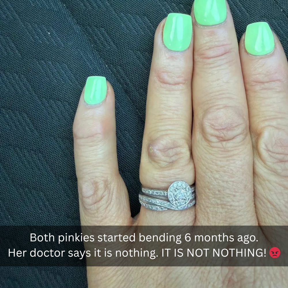 The Menopause Journal Facebook ad: Menopause did this to her hands