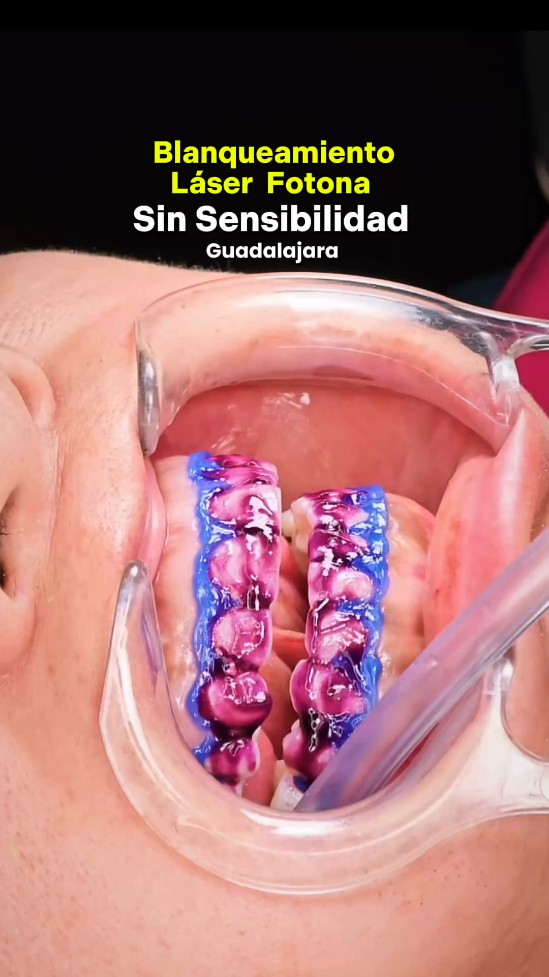 Diseño de Sonrisa Dr. Axel Navarro Facebook ad: Chatea con nosotros