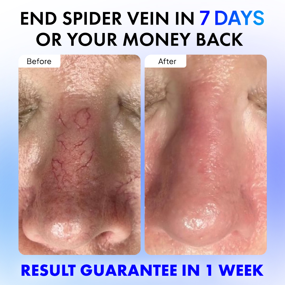 Anti-Redness US Facebook ad